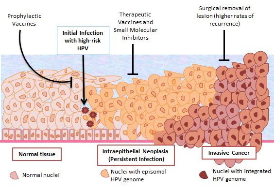 Papillomavirus infection incubation period. Papillomavirus incubation period