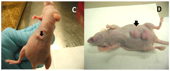Viruses | Special Issue : Expert Views on HPV Infection