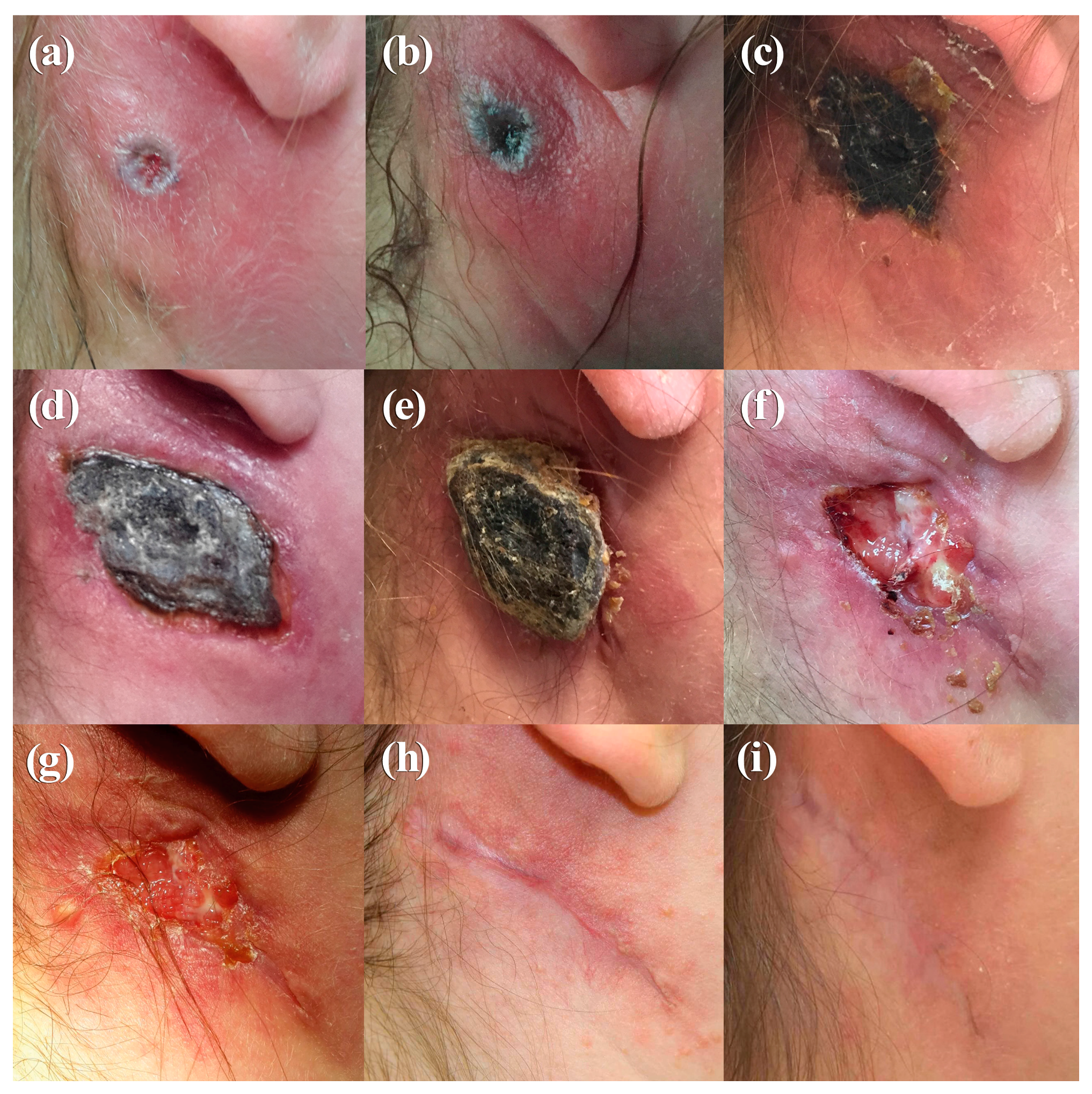 Viruses | Free Full-Text | Two Distinct Clinical Courses of Human