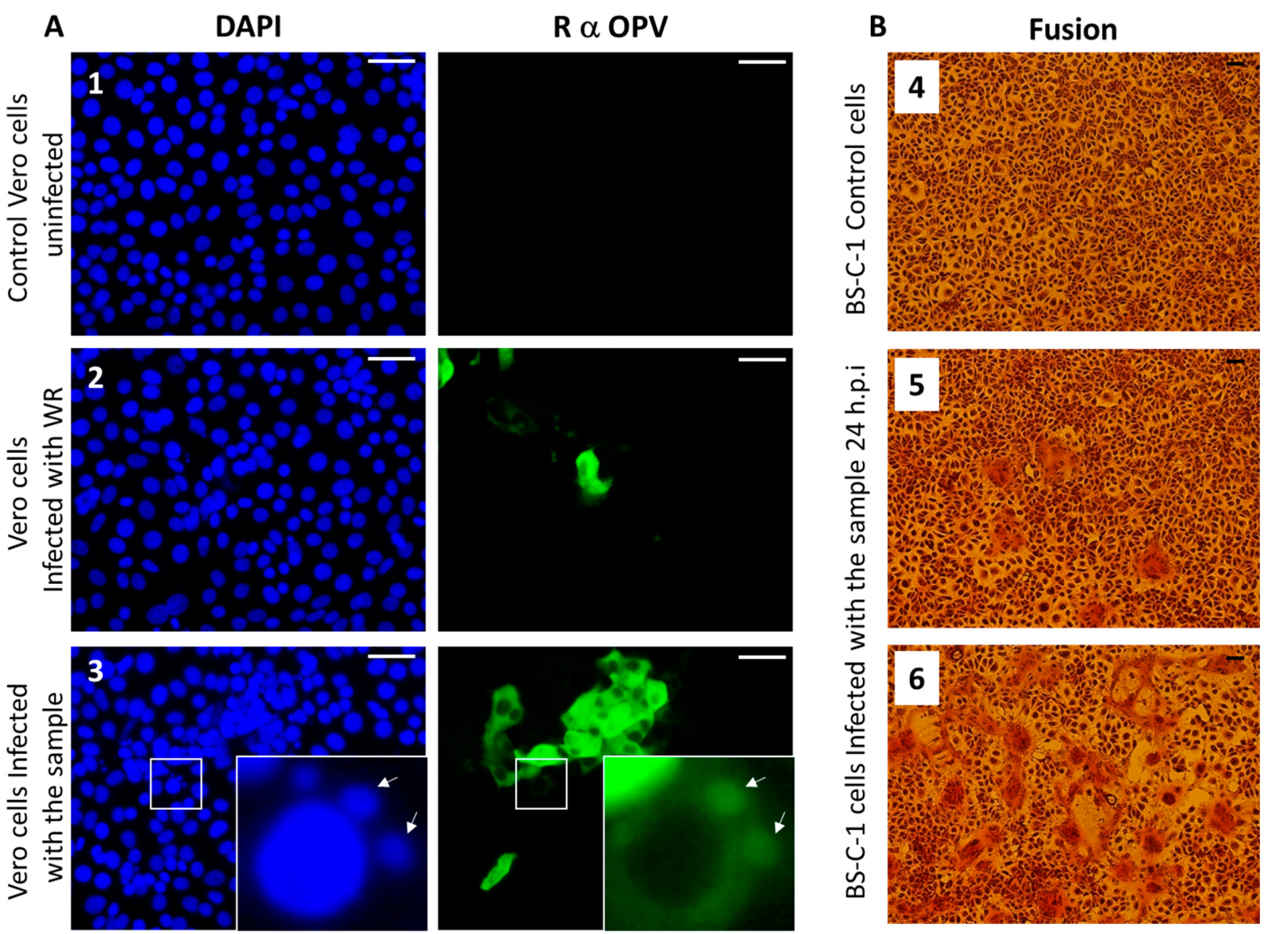 Viruses 10 00078 g004 550