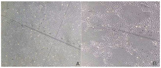 Viruses | Free Full-Text | Transcriptome Analysis of Epithelioma 