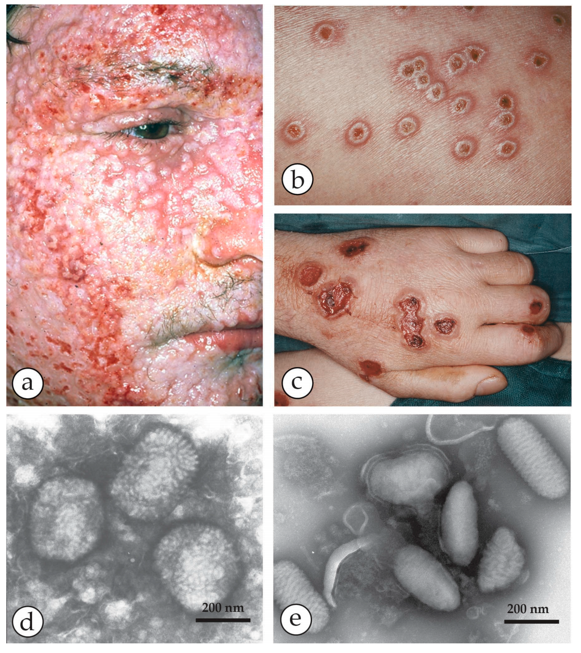 Viruses 10 00142 g003 Viruses 10 00142 g003