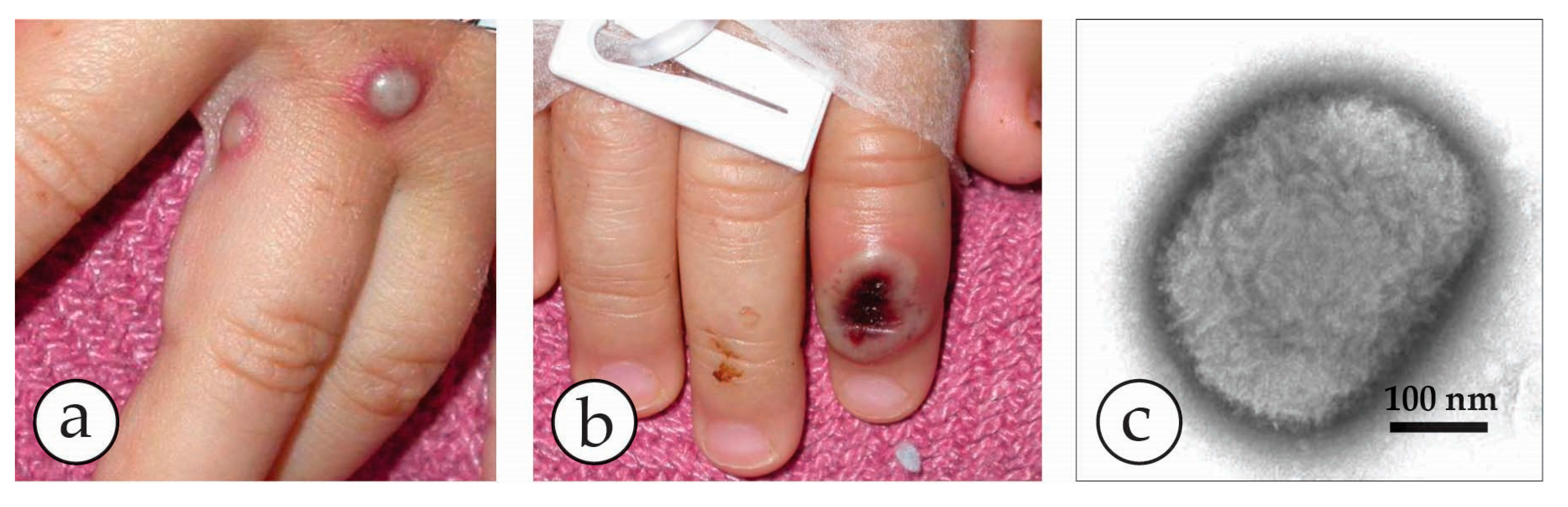 Viruses 10 00142 g005 Viruses 10 00142 g005