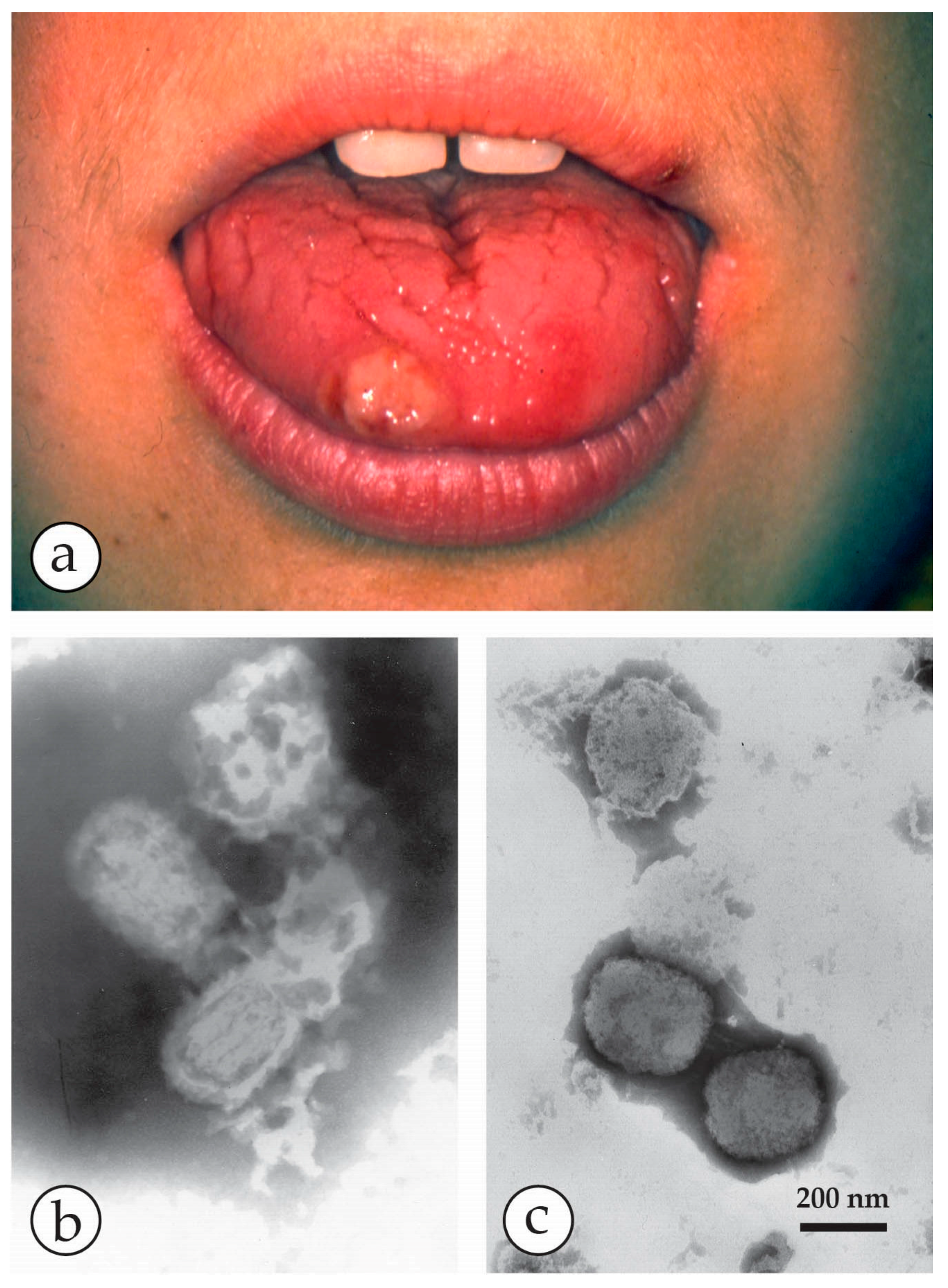 Viruses 10 00142 g015 Viruses 10 00142 g015