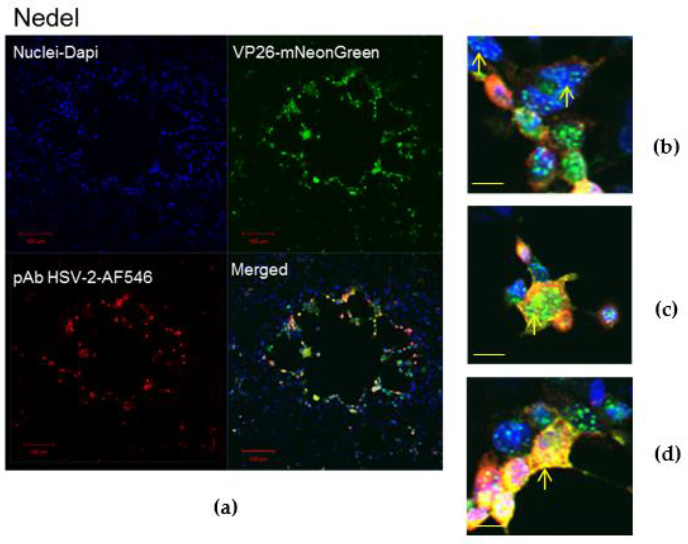 Viruses 10 00246 g002a Viruses 10 00246 g002a