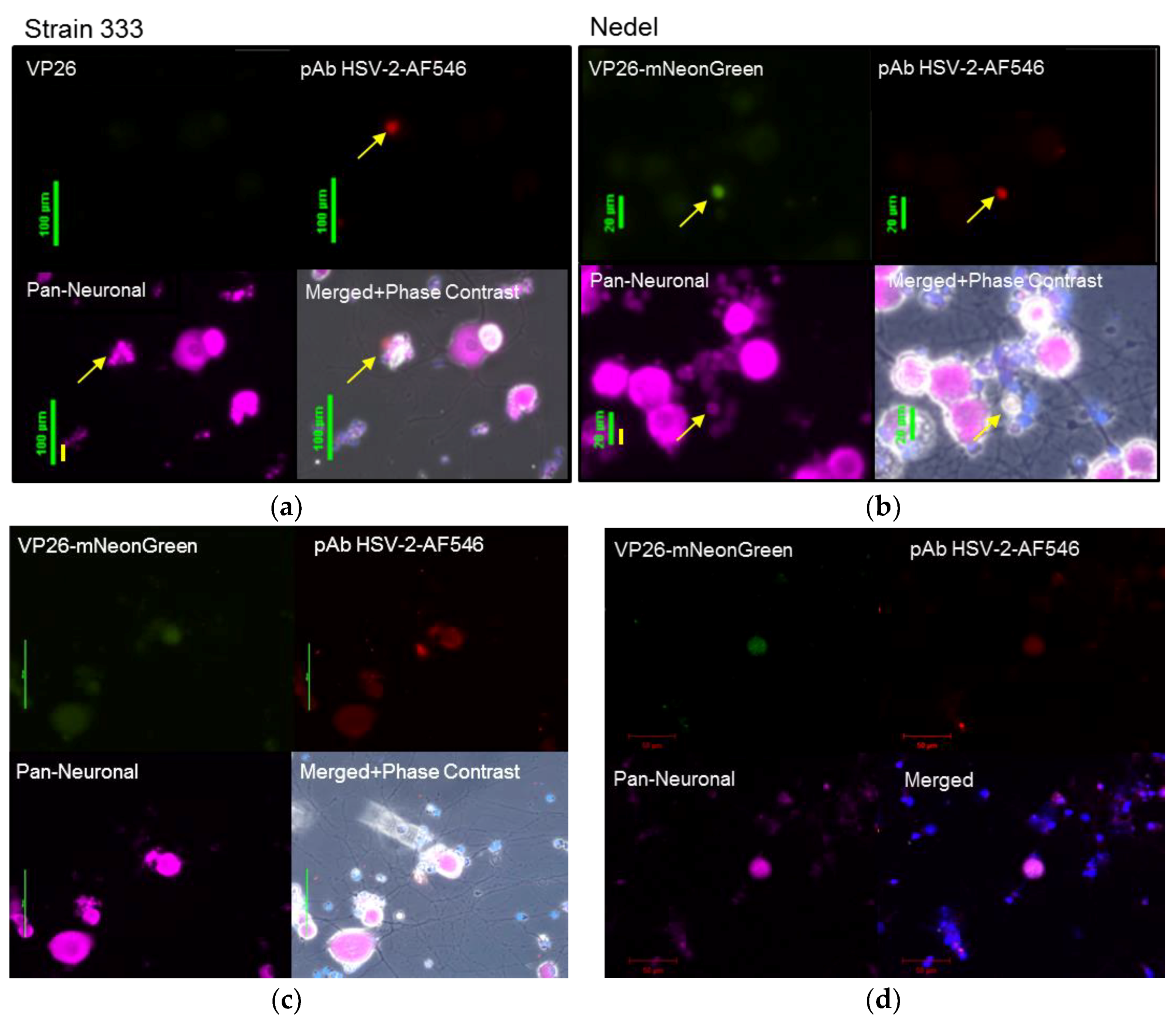 Viruses 10 00246 g006 Viruses 10 00246 g006