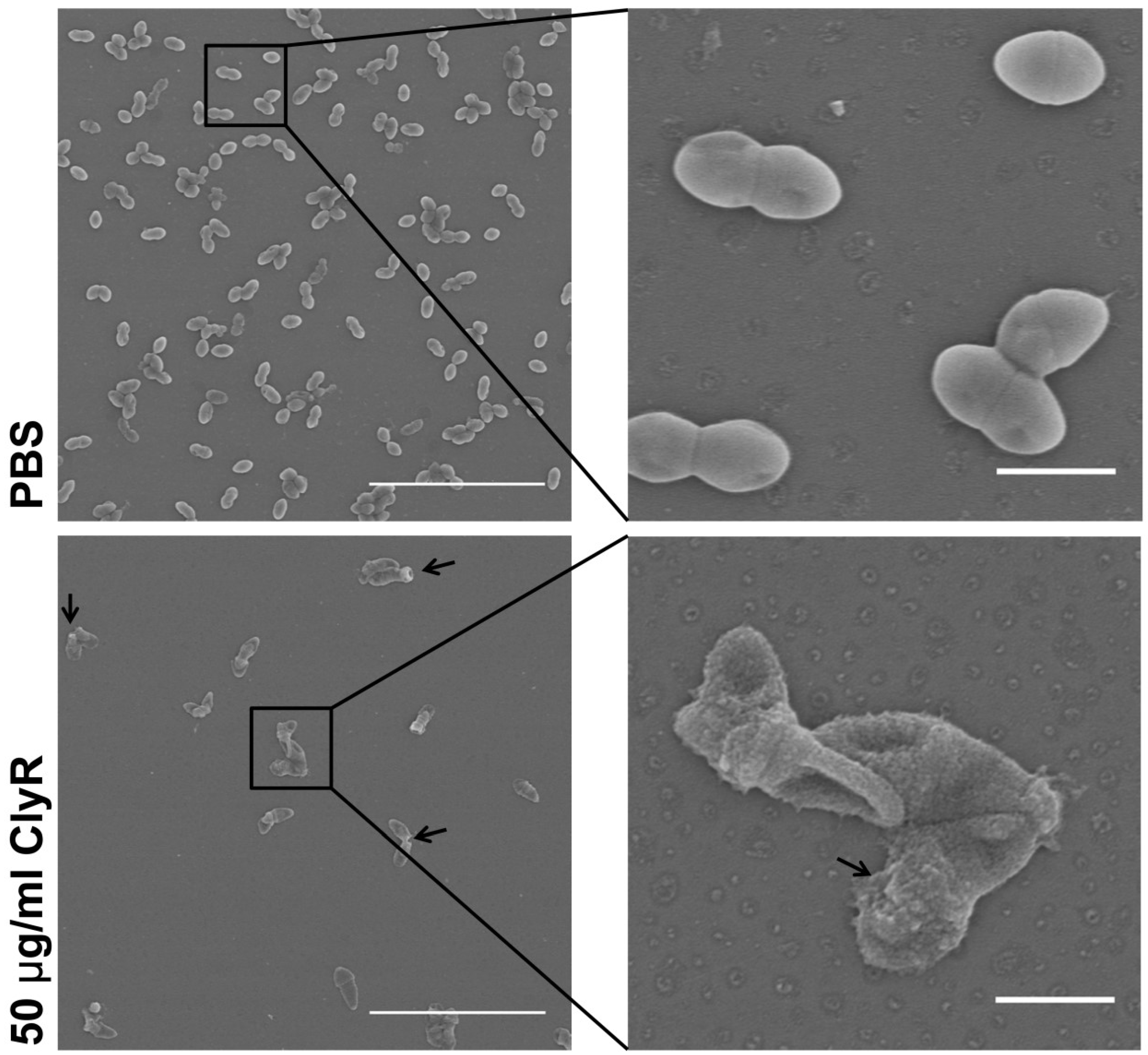 Viruses 10 00290 g004