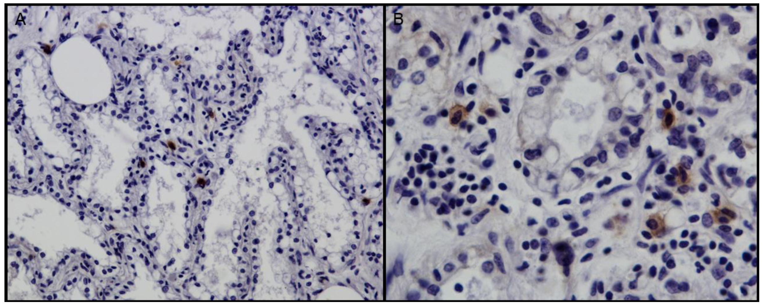 Viruses 10 00315 g002