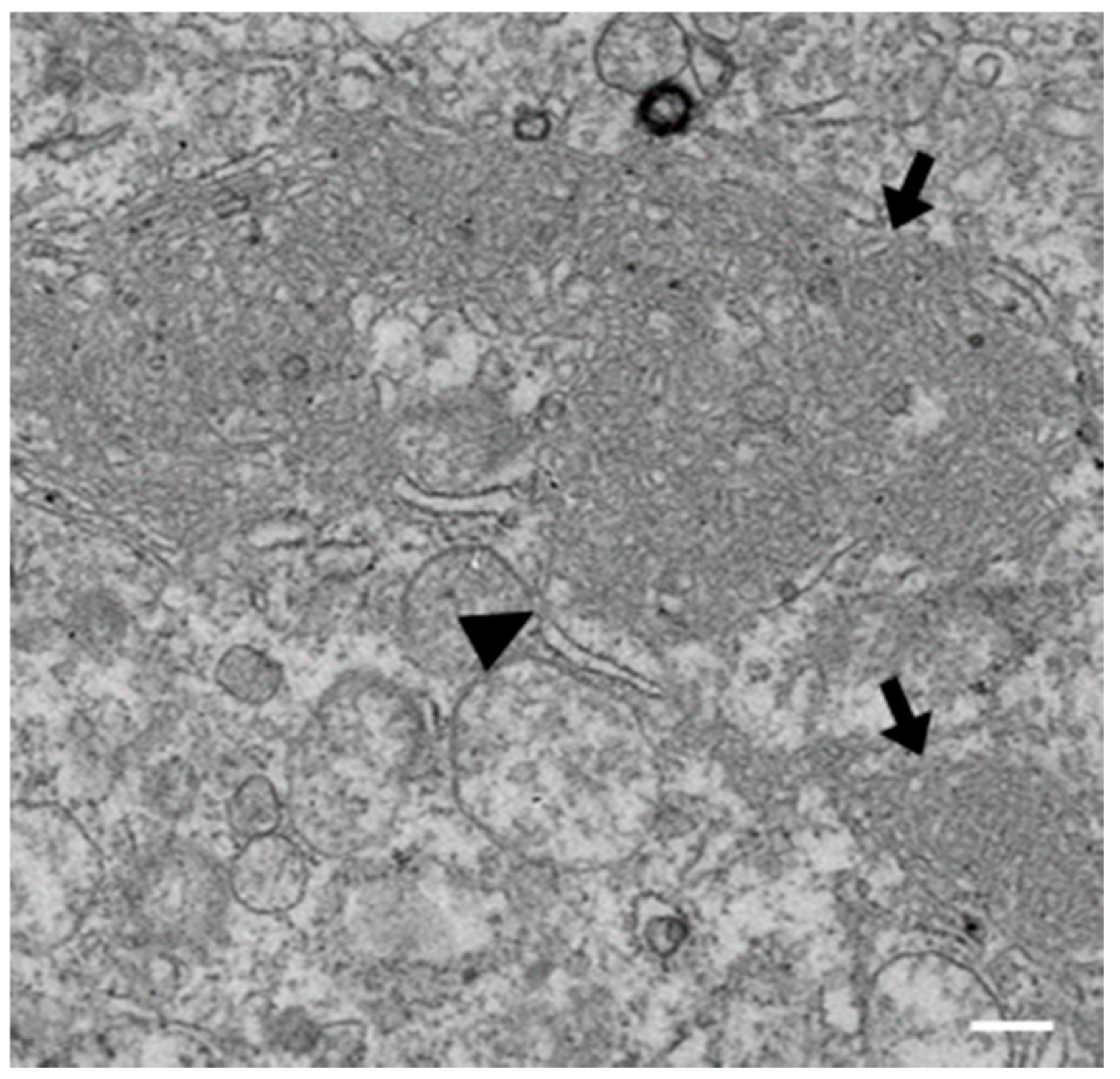 Viruses 10 00477 g005 Viruses 10 00477 g005