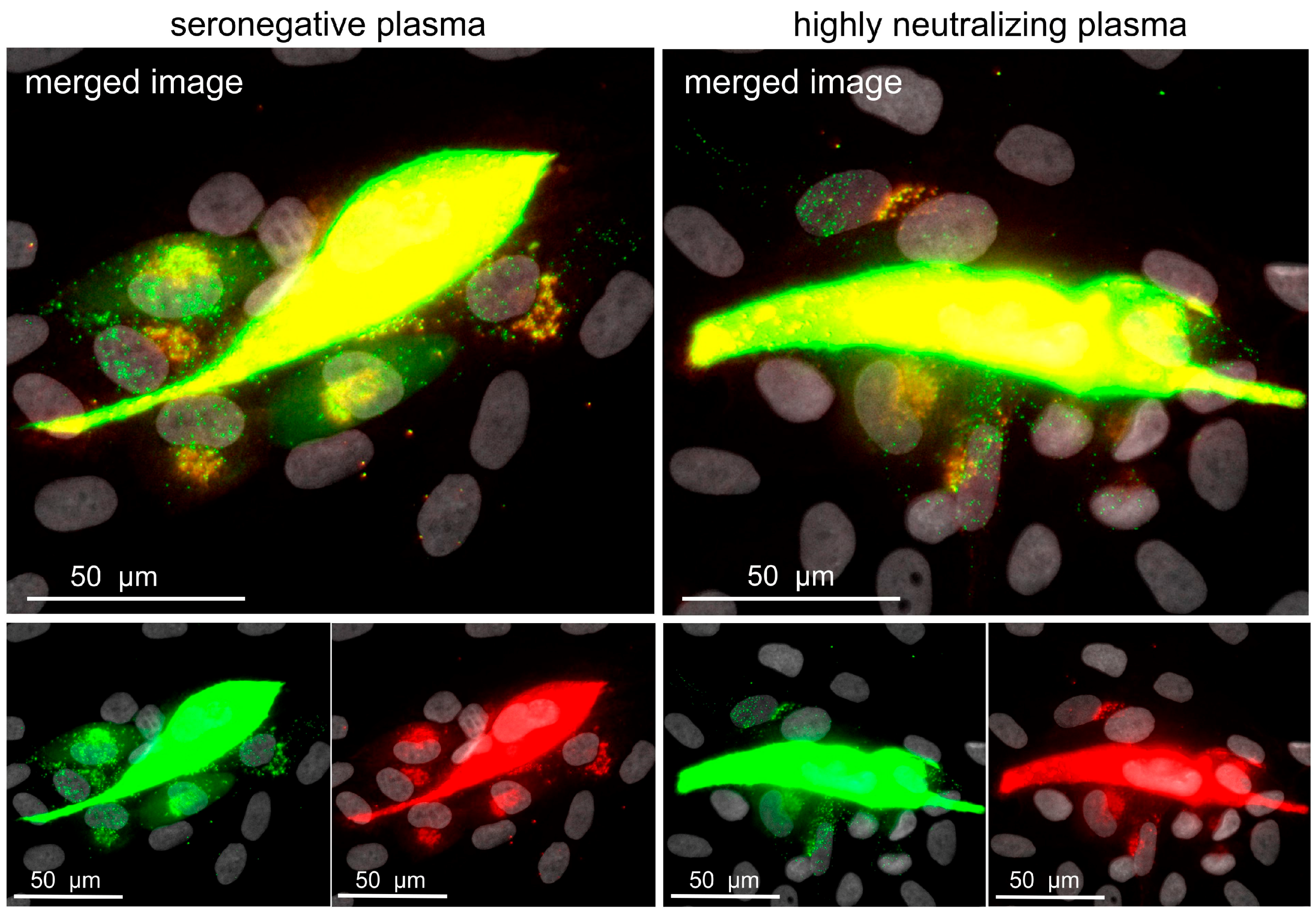 Viruses 10 00500 g005 Viruses 10 00500 g005