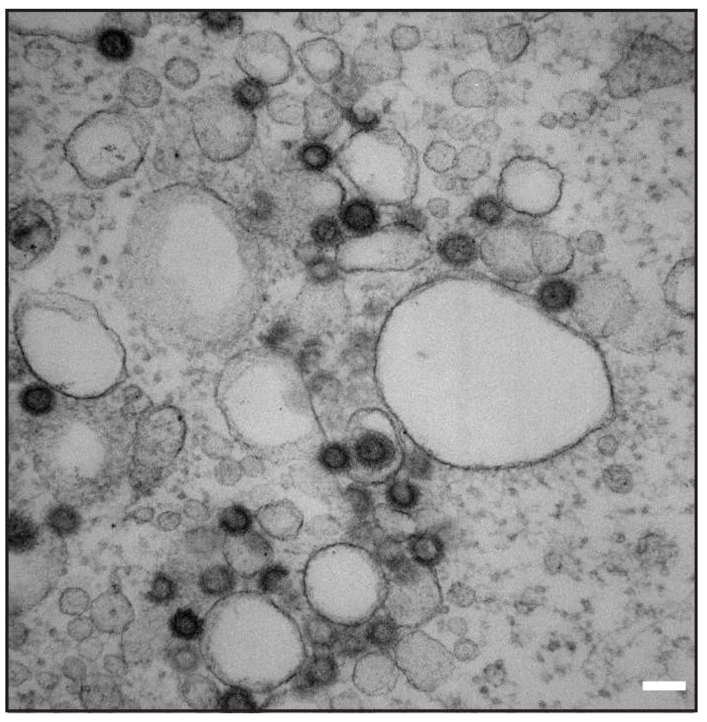 Viruses 10 00575 g009 Viruses 10 00575 g009