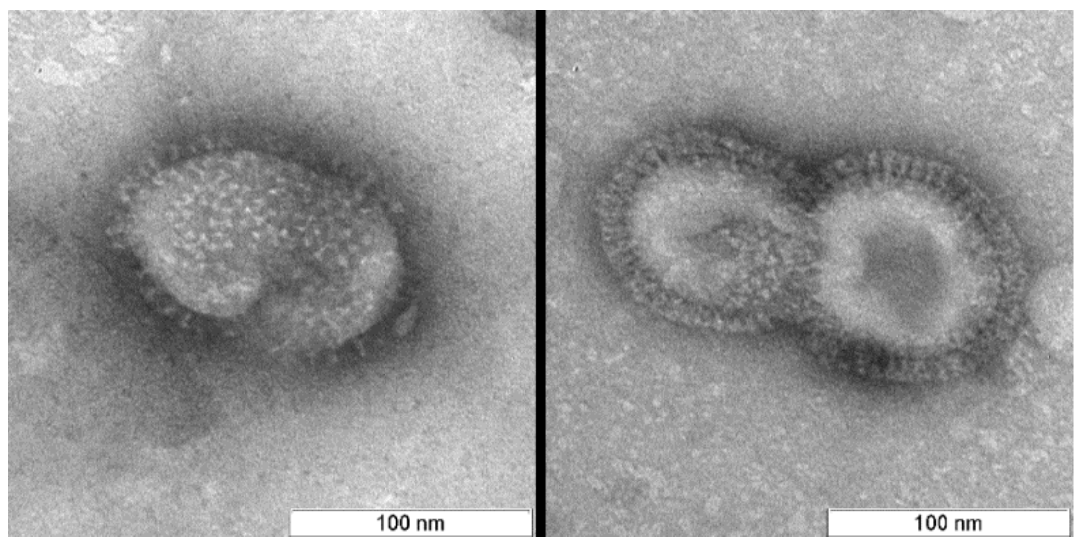 Viruses | Free Full-Text | Ultrastructural Aspects of ...