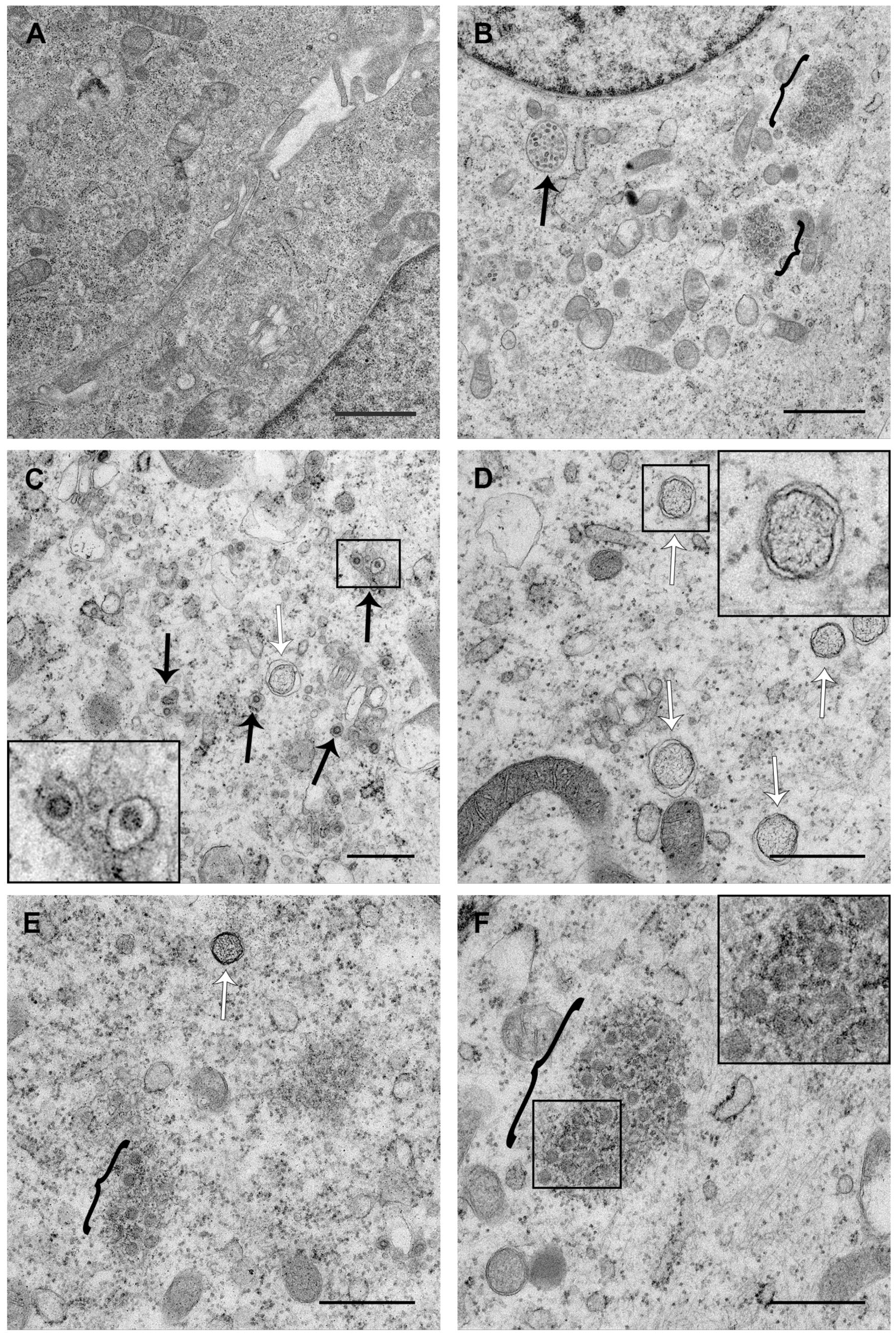 Viruses 11 01030 g005