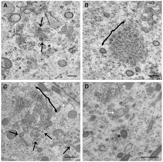 The Porcine Deltacoronavirus Replication Organelle Comprises The Porcine Deltacoronavirus Replication Organelle Comprises