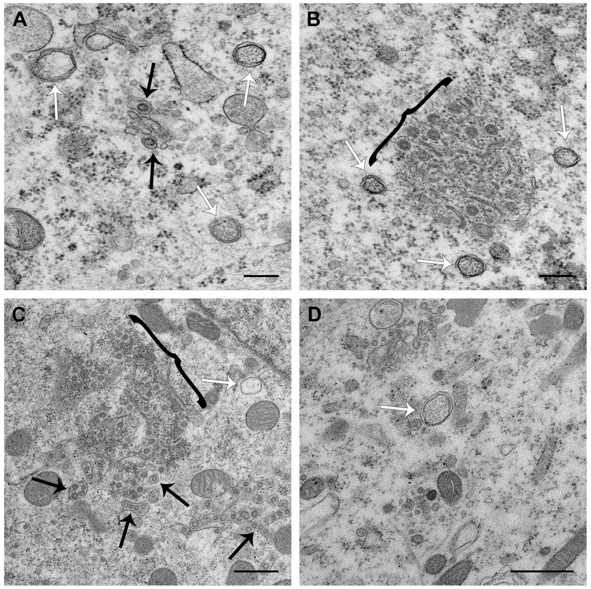 Viruses 11 01030 g006