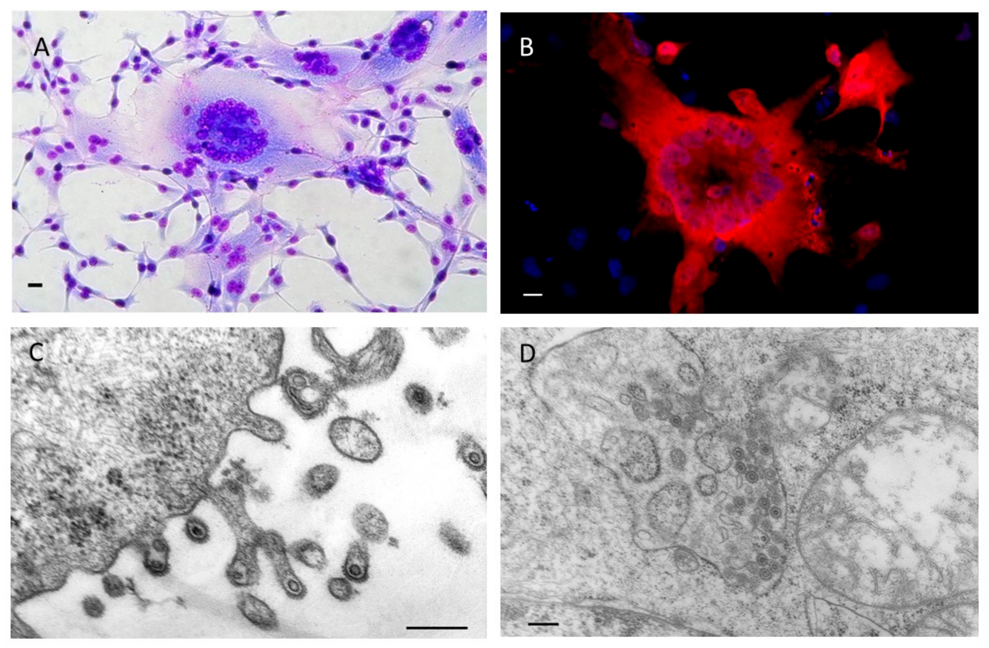 Viruses 11 01084 g003 Viruses 11 01084 g003