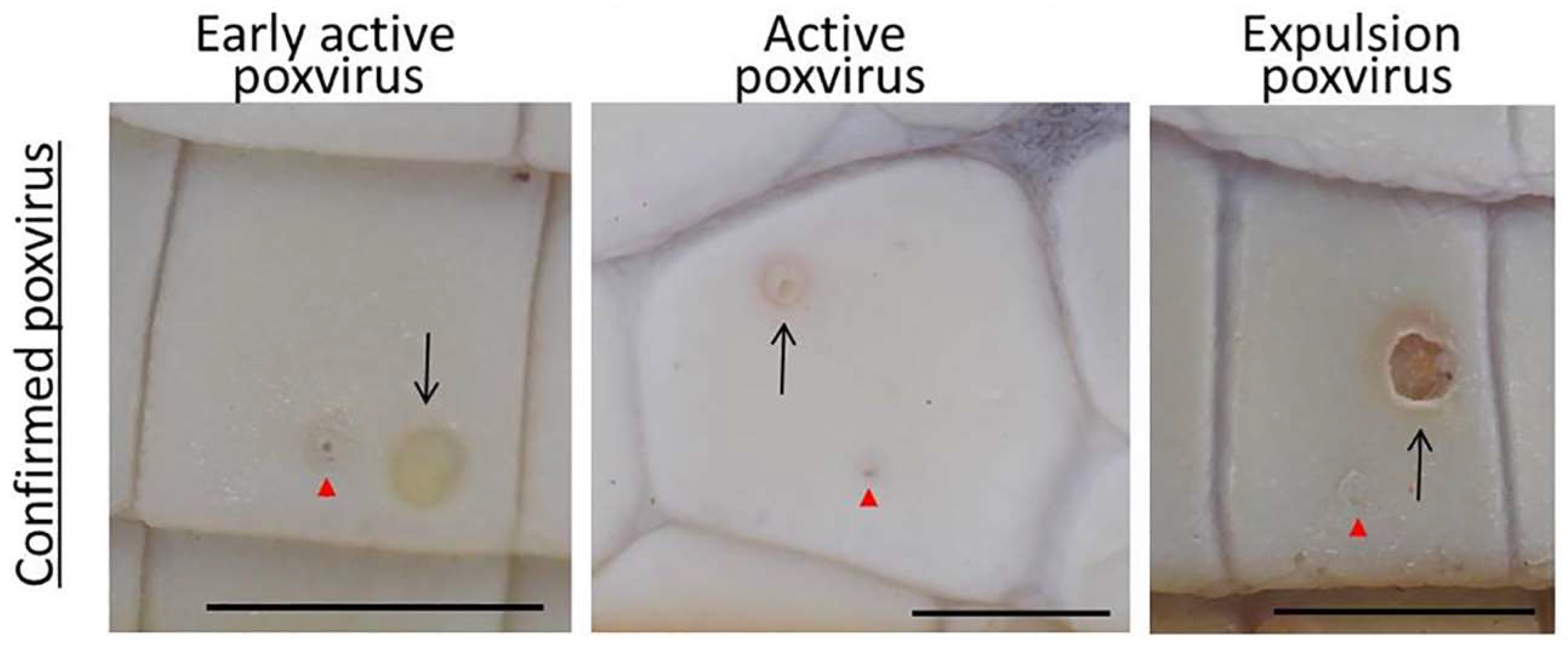 Viruses 11 01116 g001 Viruses 11 01116 g001