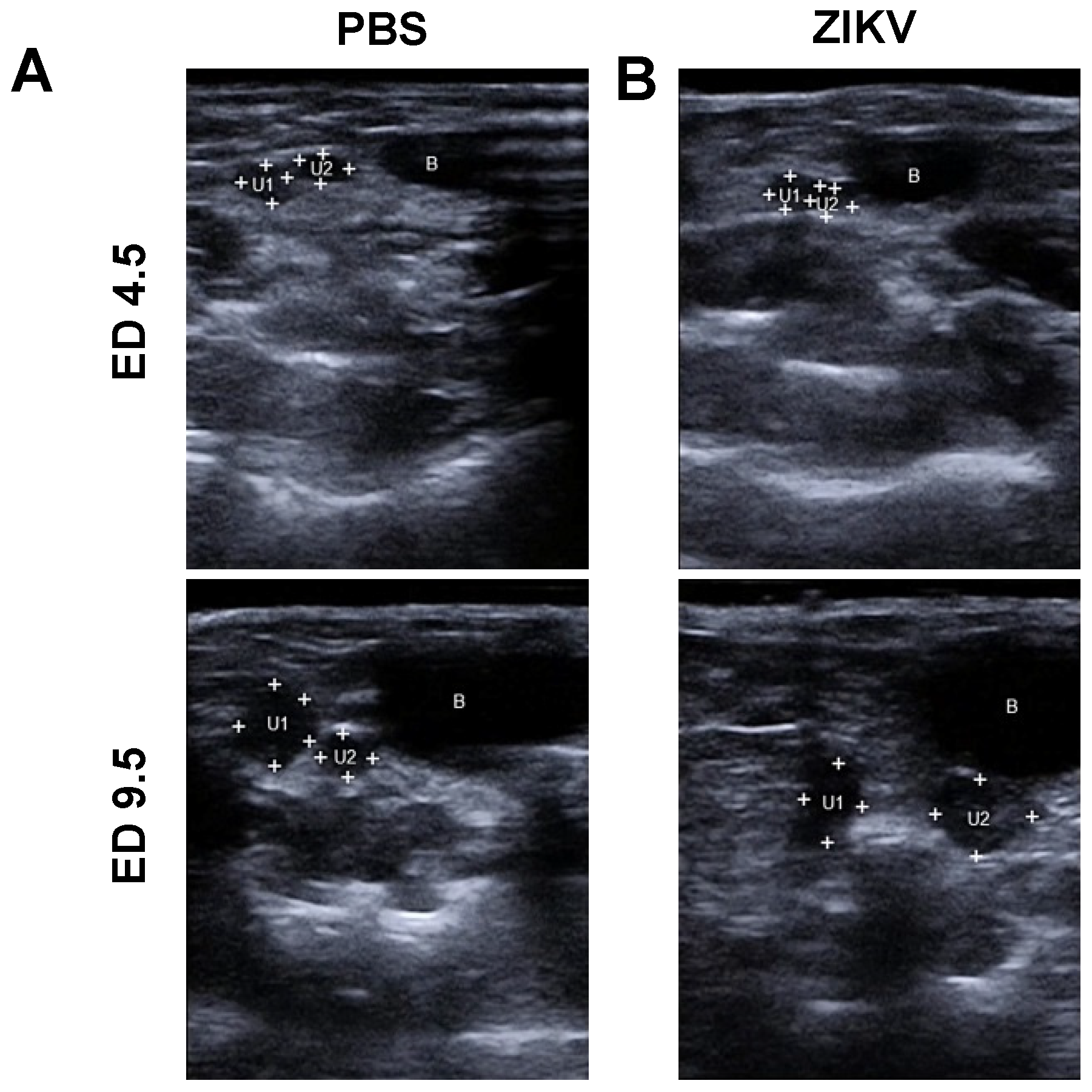 Viruses 12 00072 g001a Viruses 12 00072 g001a