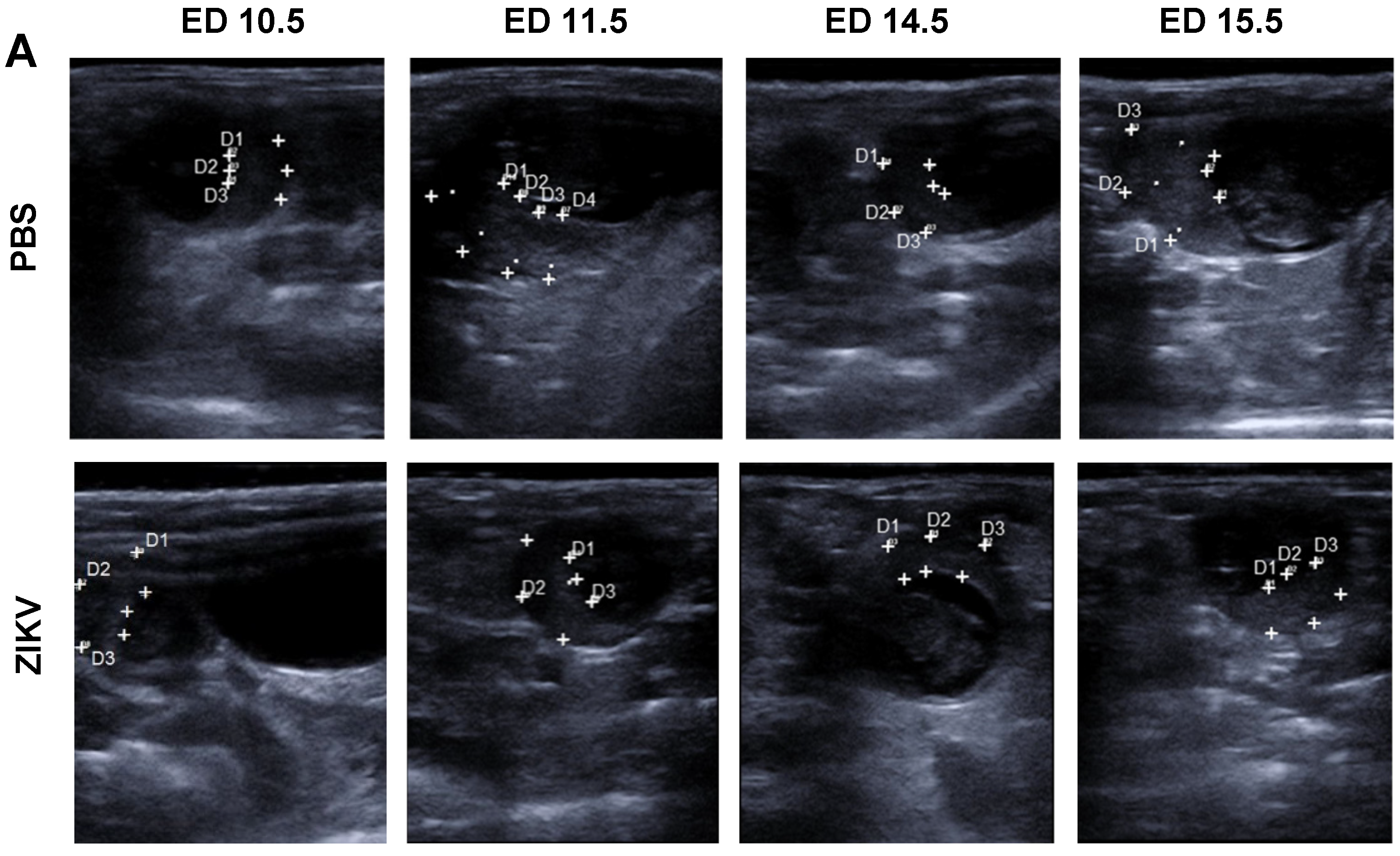 Viruses 12 00072 g003a Viruses 12 00072 g003a