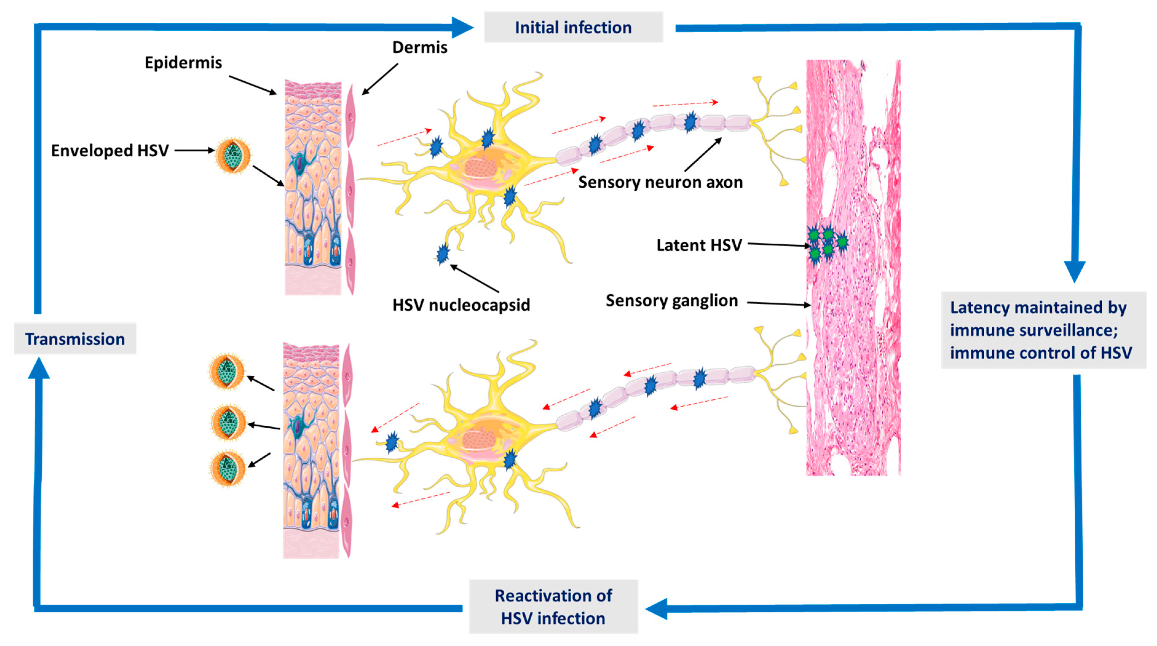 Herpes Simplex virus 1/2 на слизистой