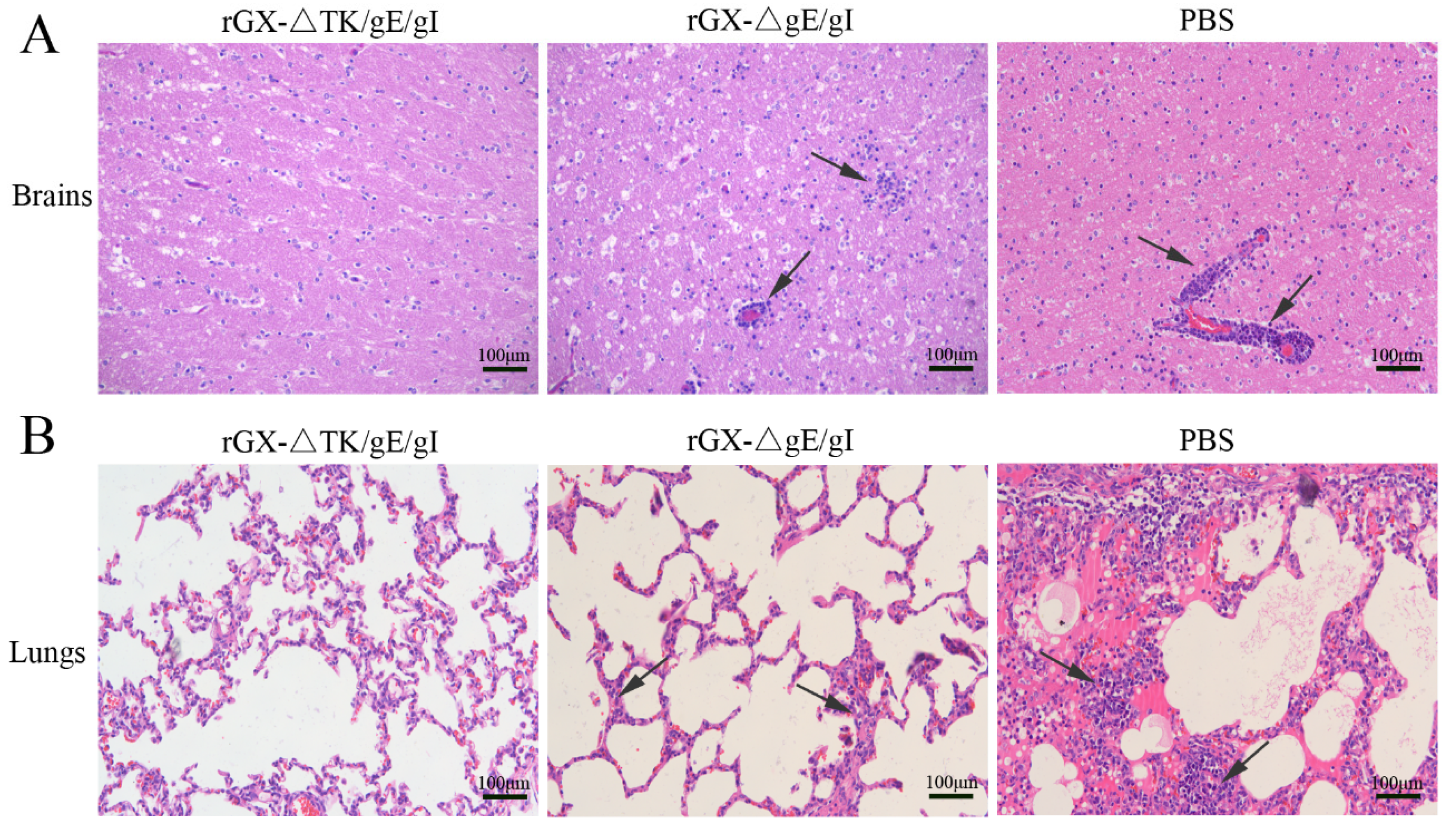 Viruses 12 00369 g007
