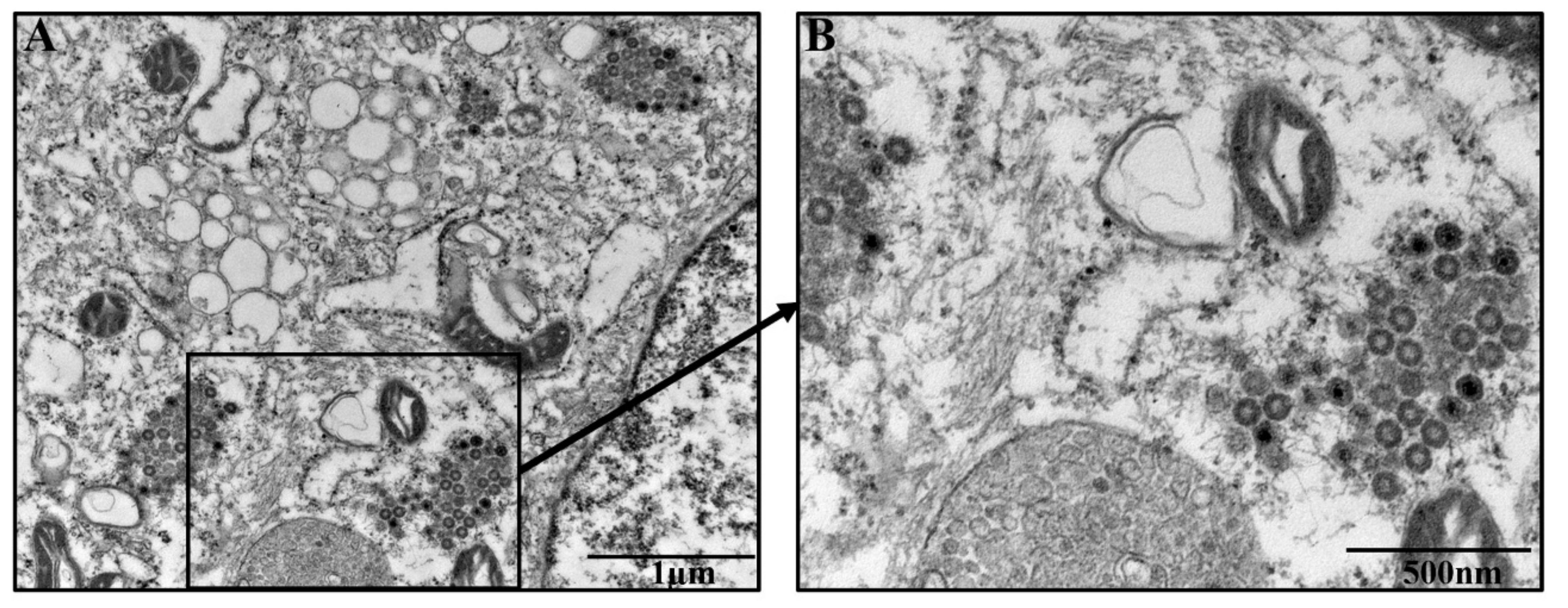 Viruses 12 00391 g003