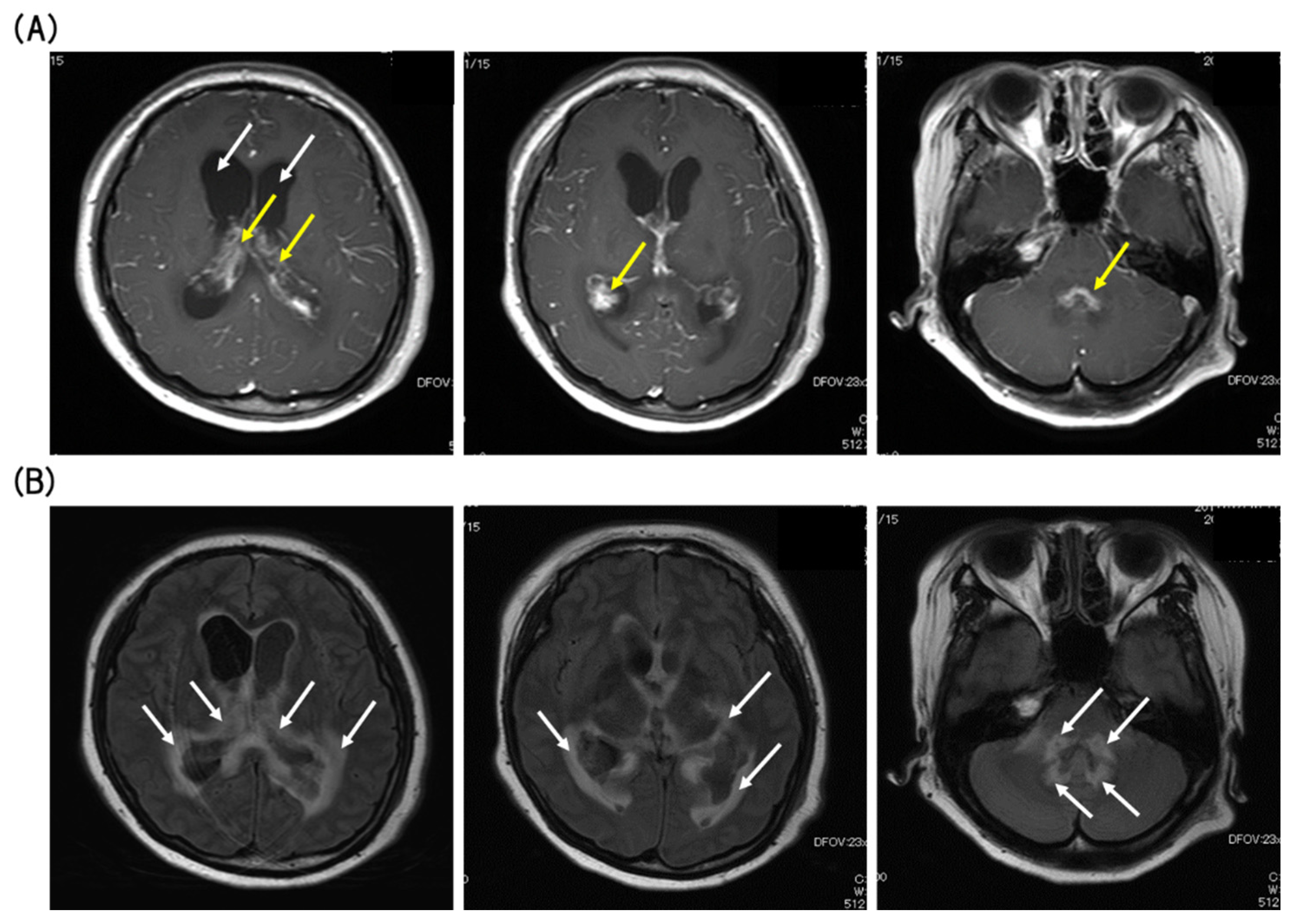 Viruses 12 00416 g002 Viruses 12 00416 g002