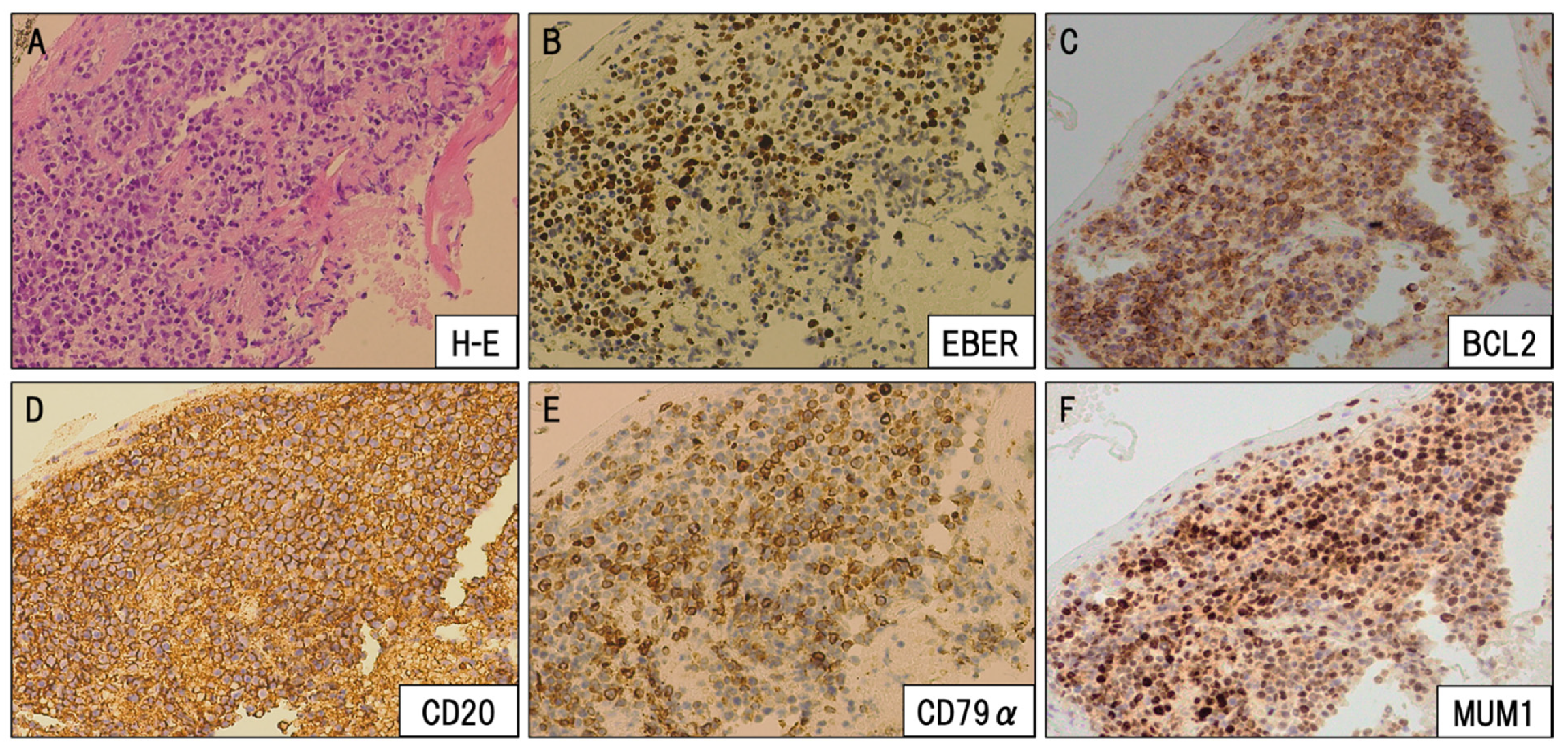 Viruses 12 00416 g004 Viruses 12 00416 g004