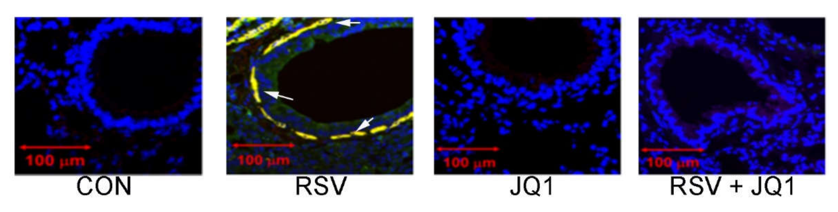 Viruses 12 00472 g007
