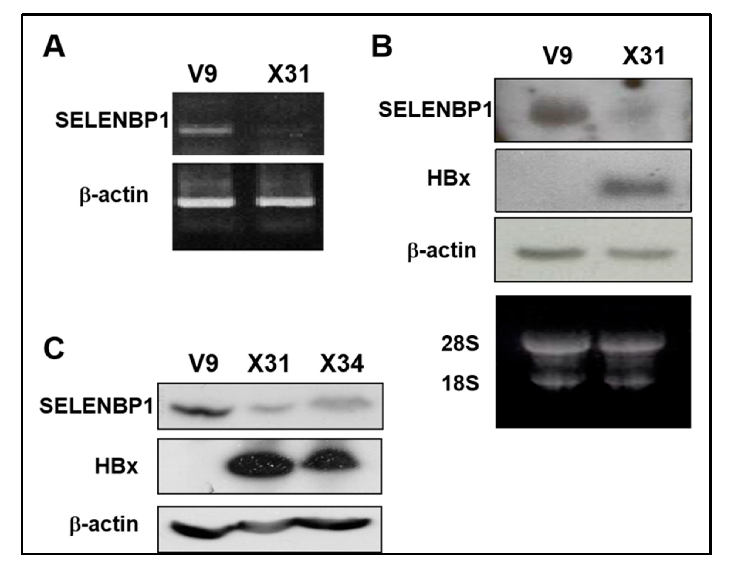 シモンズグランドセール Hepatitis B Selenium of Expression Downregulates Virus-X ポップス/ロック(邦楽)