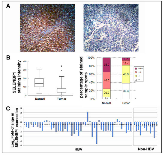 Structure-based virtual screening and in vitro validation of