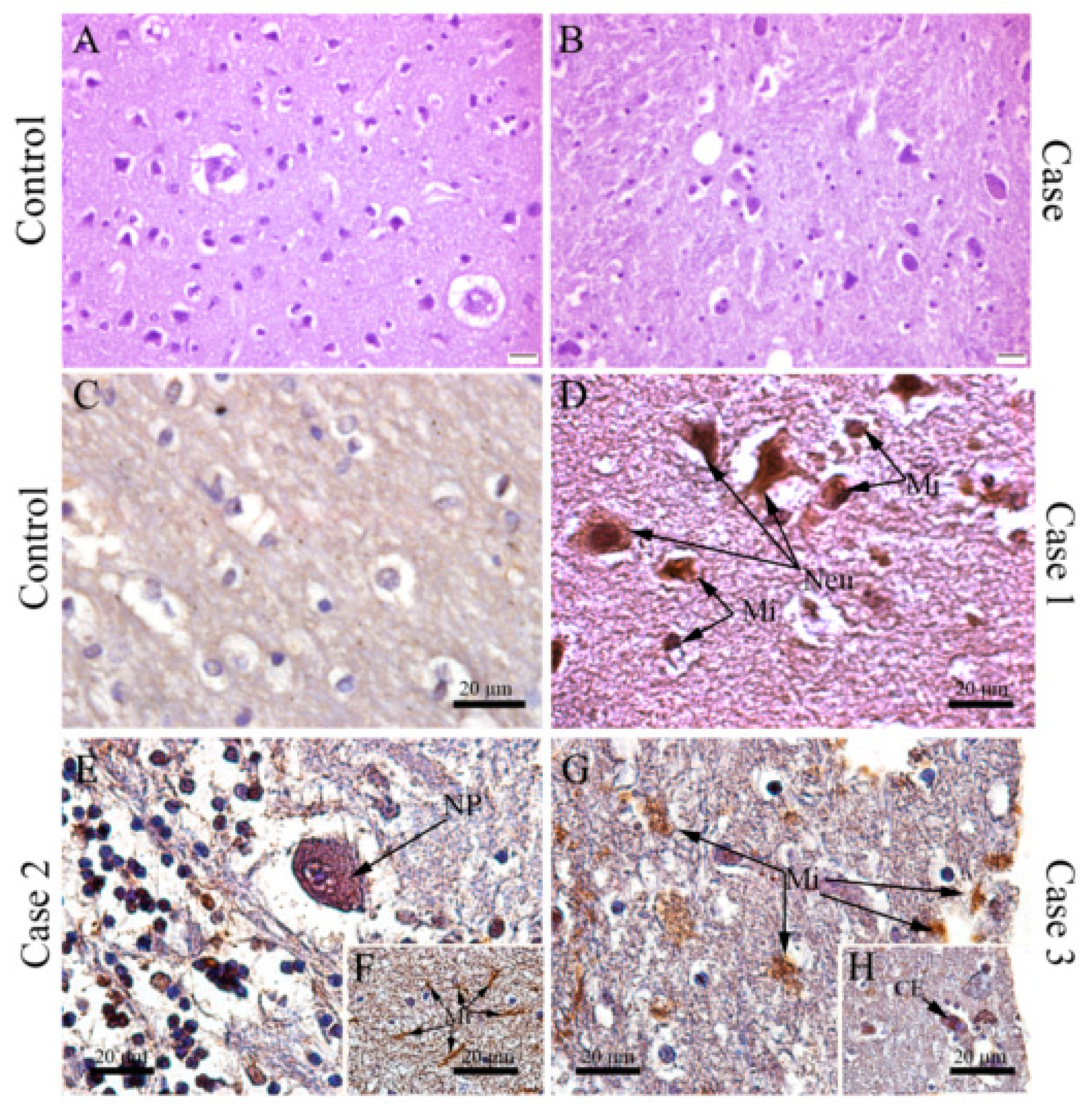 Viruses 12 00603 g003