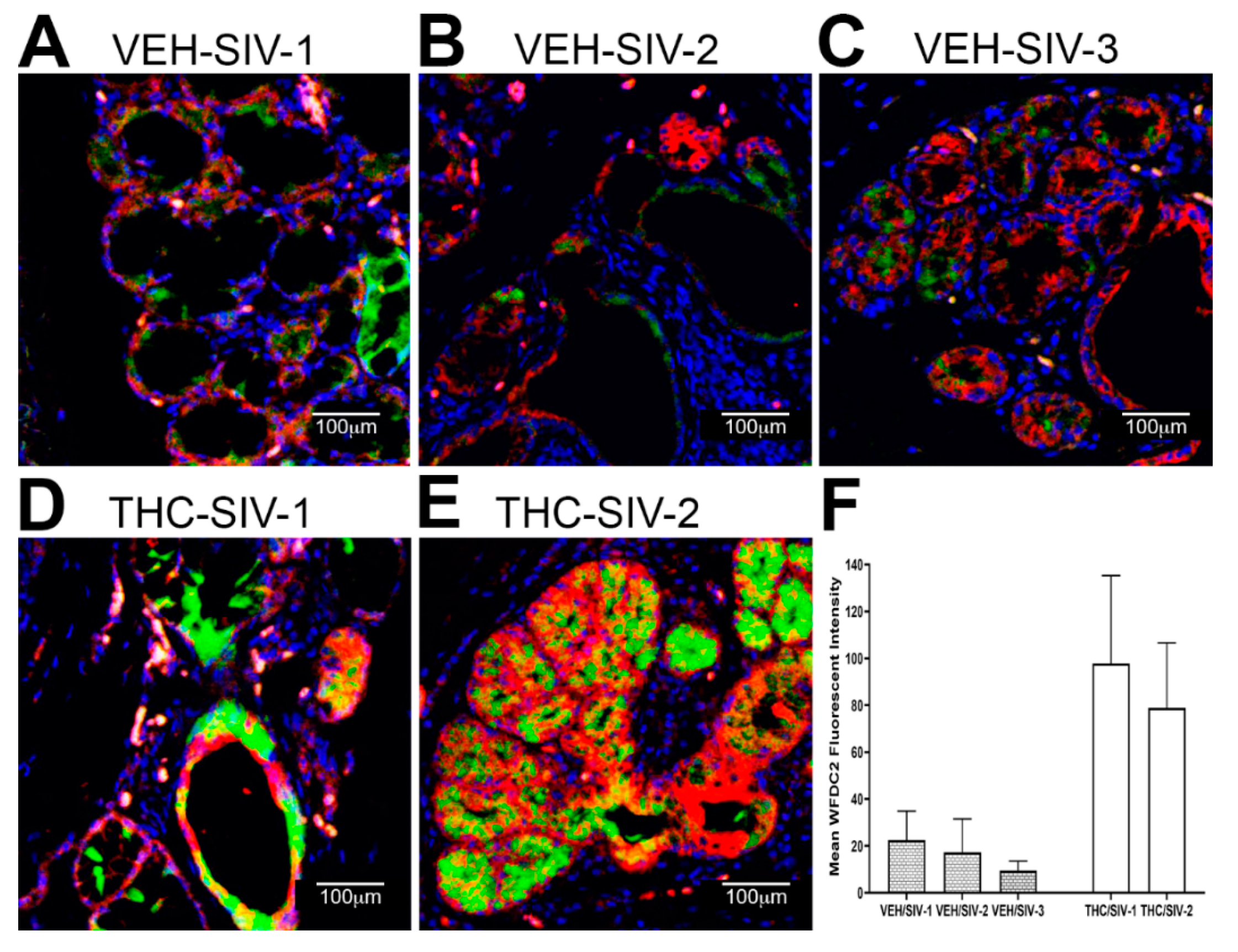 Viruses Free Full Text Long Term Delta 9 Tetrahydrocannabinol Administration Inhibits Proinflammatory Responses In Minor Salivary Glands Of Chronically Simian Immunodeficieny Virus Infected Rhesus Macaques Html