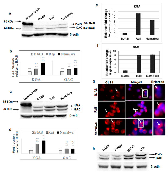Viruses Free Full Text Upregulation Of Gls1 Isoforms Kga And Gac Facilitates Mitochondrial Metabolism And Cell Proliferation In Epstein Barr Virus Infected Cells Html