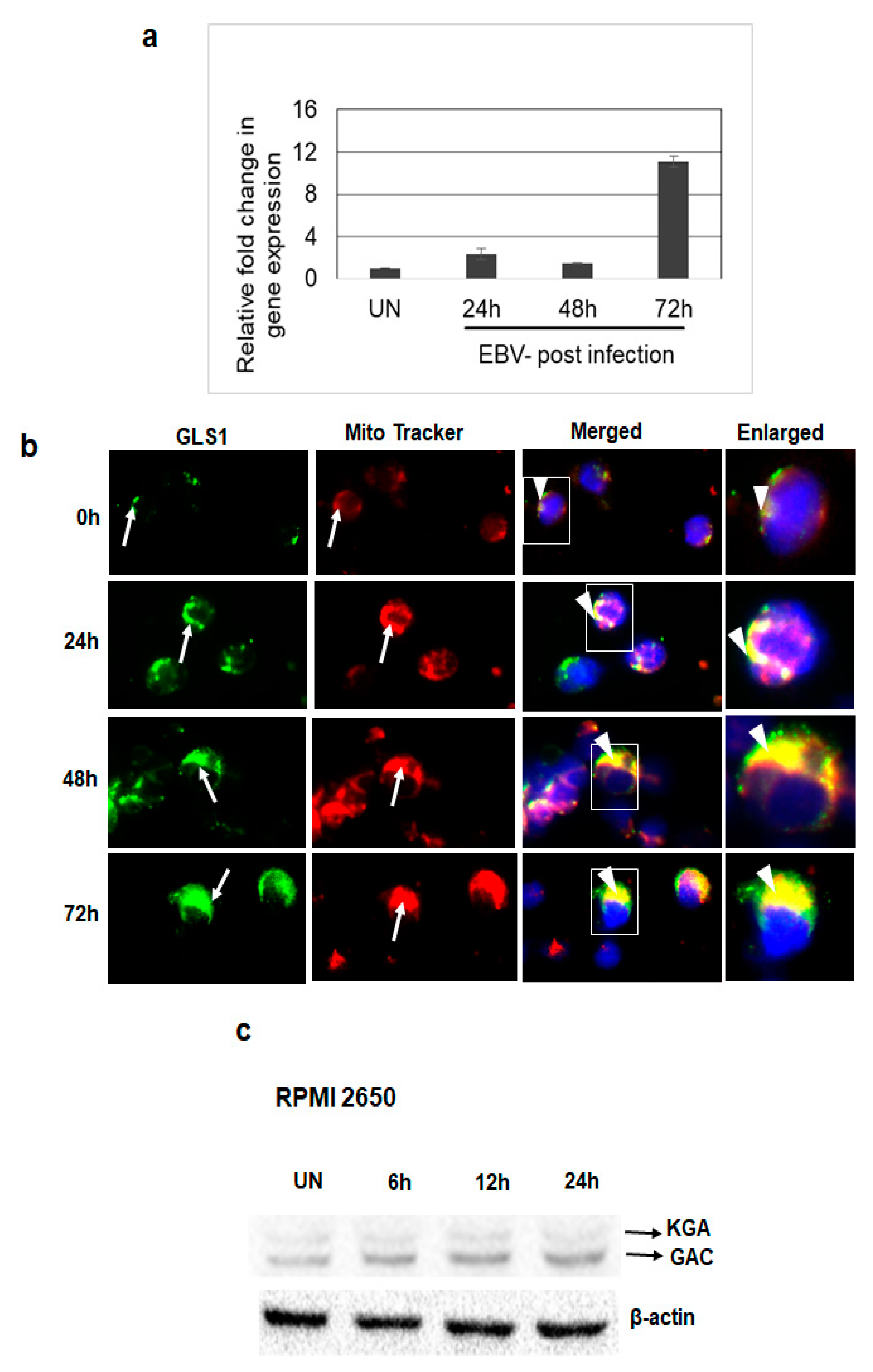 Viruses Free Full Text Upregulation Of Gls1 Isoforms Kga And Gac Facilitates Mitochondrial Metabolism And Cell Proliferation In Epstein Barr Virus Infected Cells Html