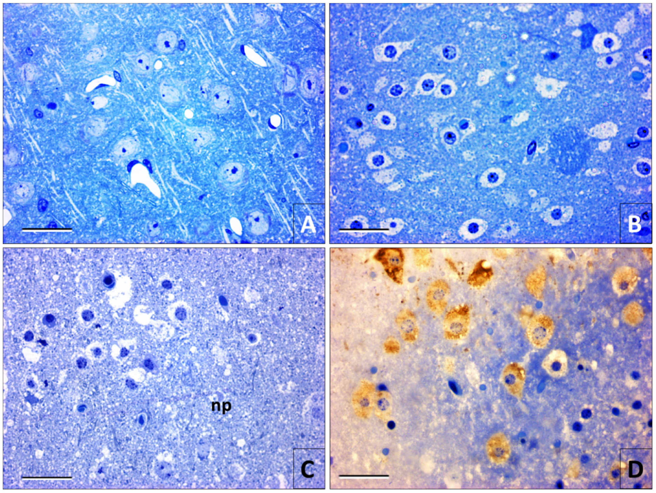 Viruses 12 00938 g004 Viruses 12 00938 g004