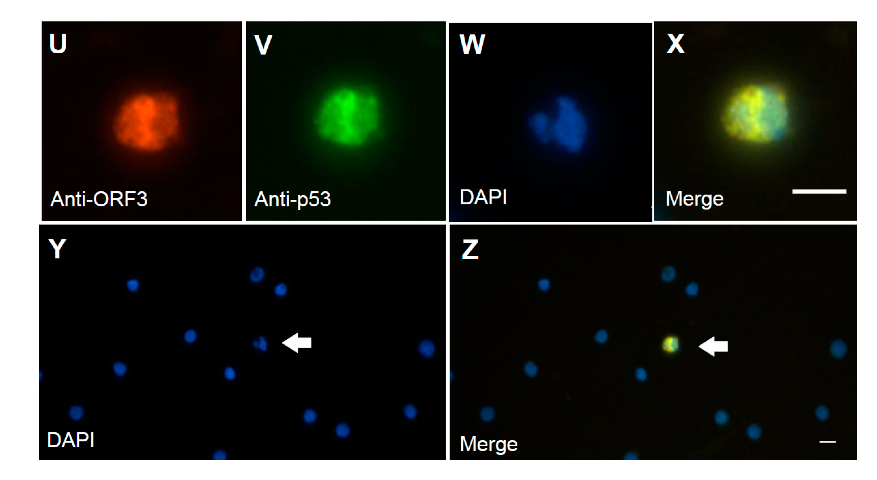 Viruses 12 00961 g003b Viruses 12 00961 g003b