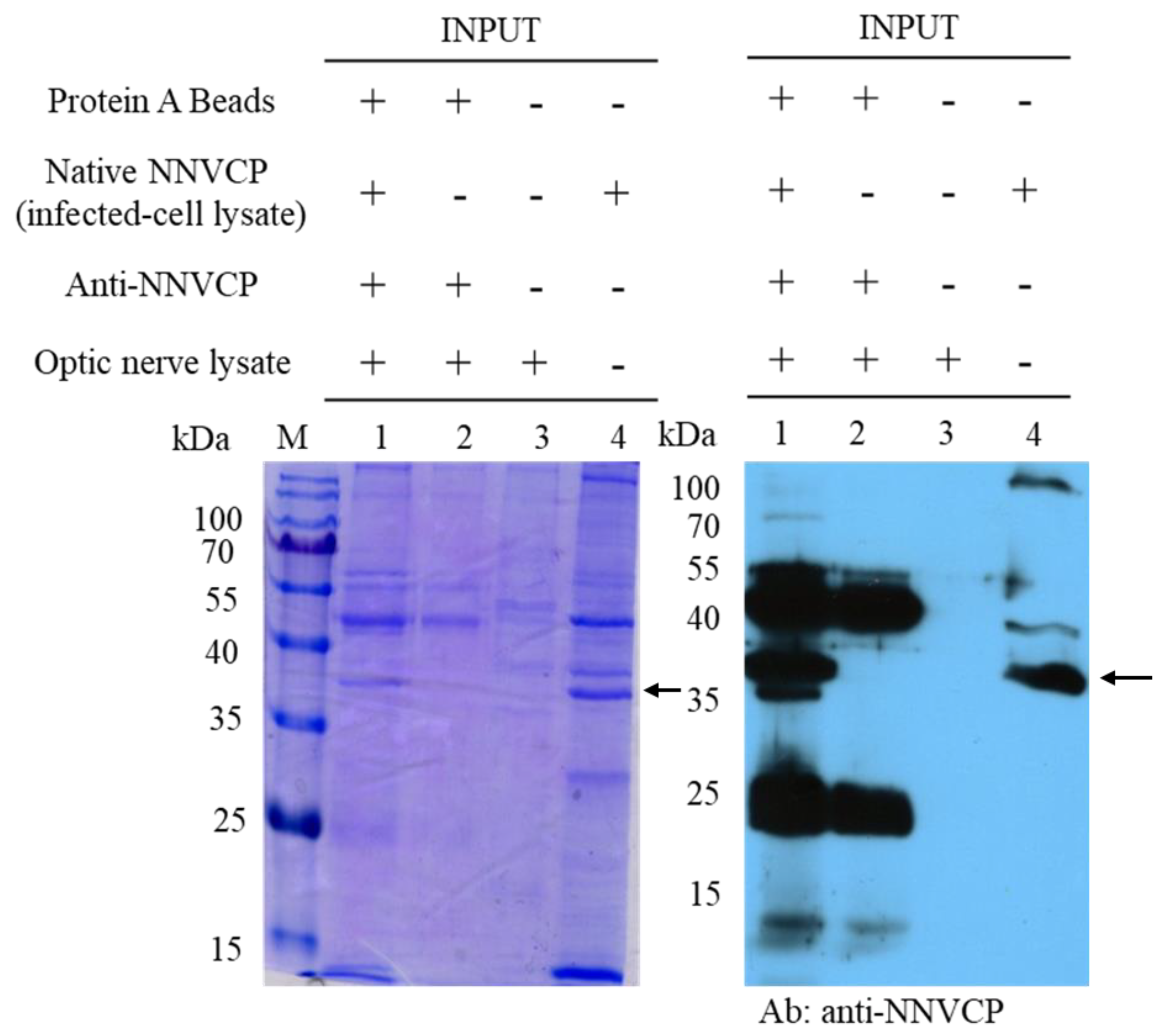 Viruses 12 00985 g001 Viruses 12 00985 g001