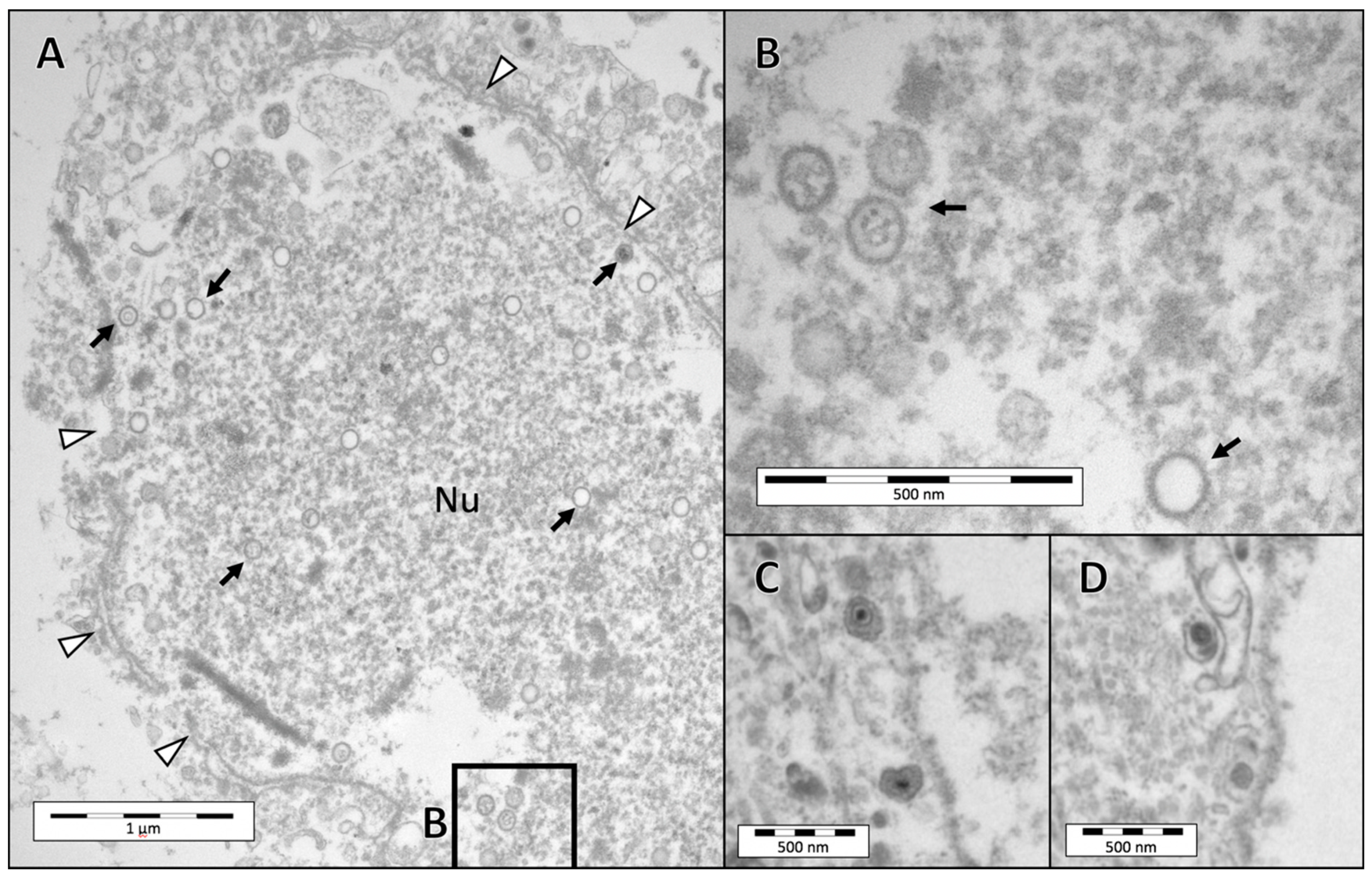 Viruses 12 01007 g004