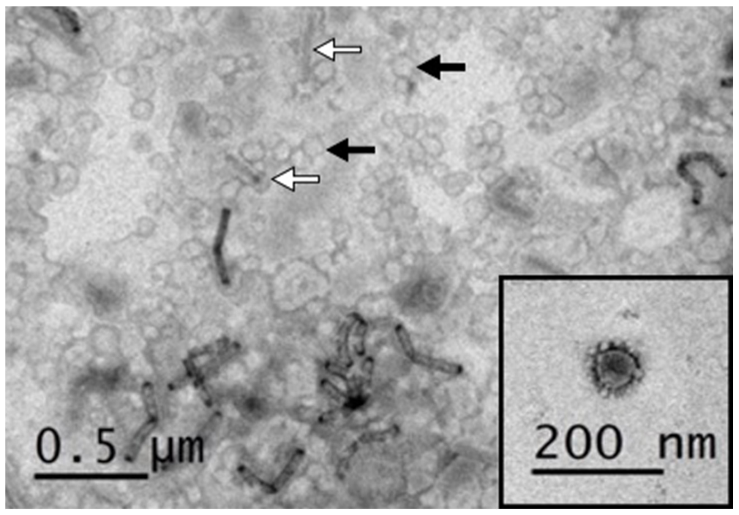 Viruses 12 01122 g005