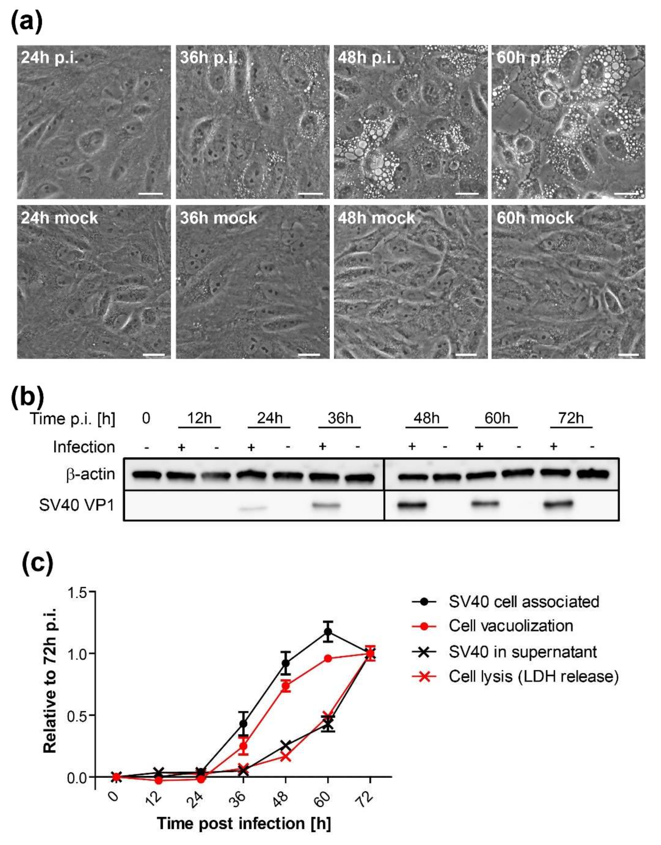 Viruses 12 01128 g004