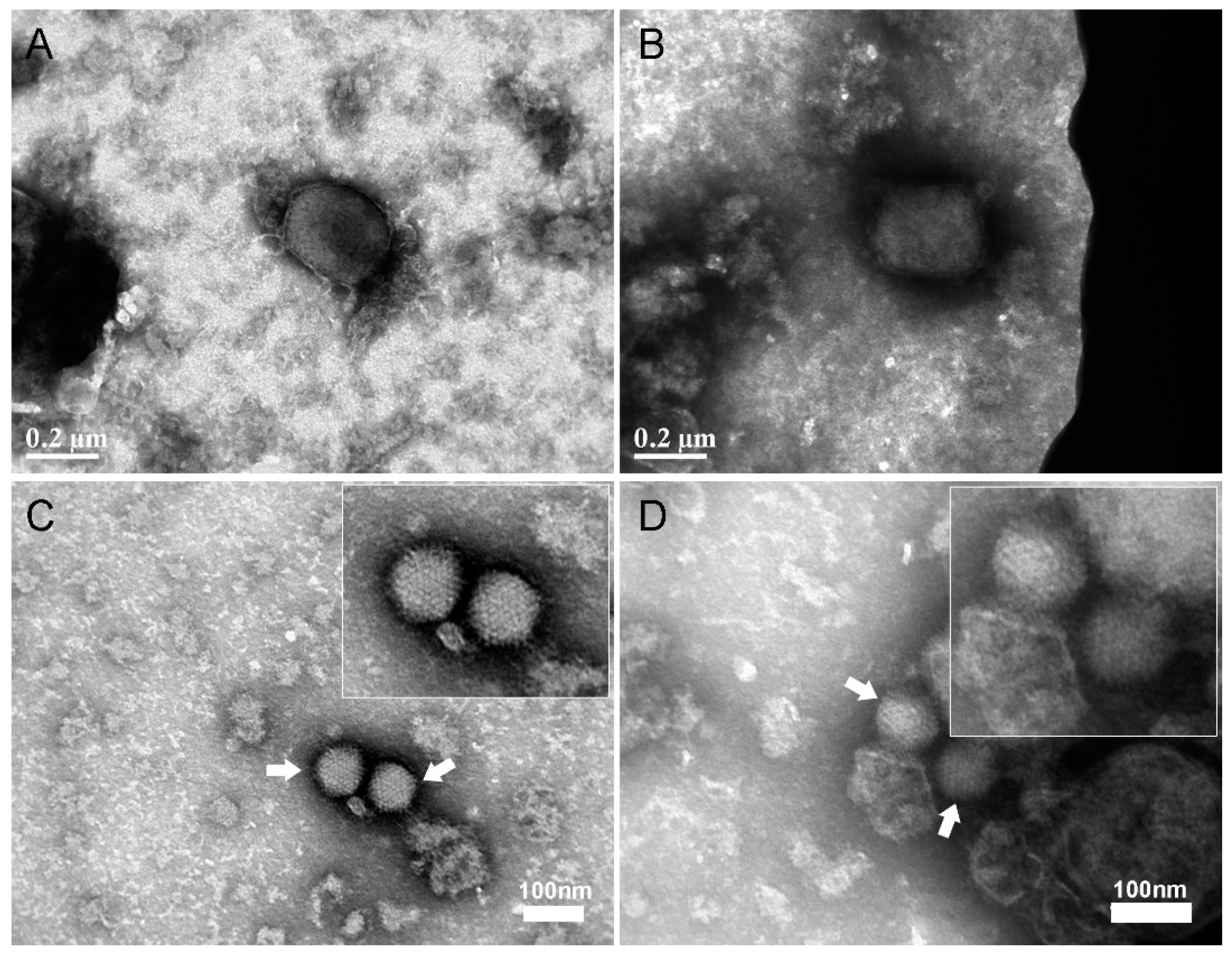 Viruses 12 01165 g003 Viruses 12 01165 g003