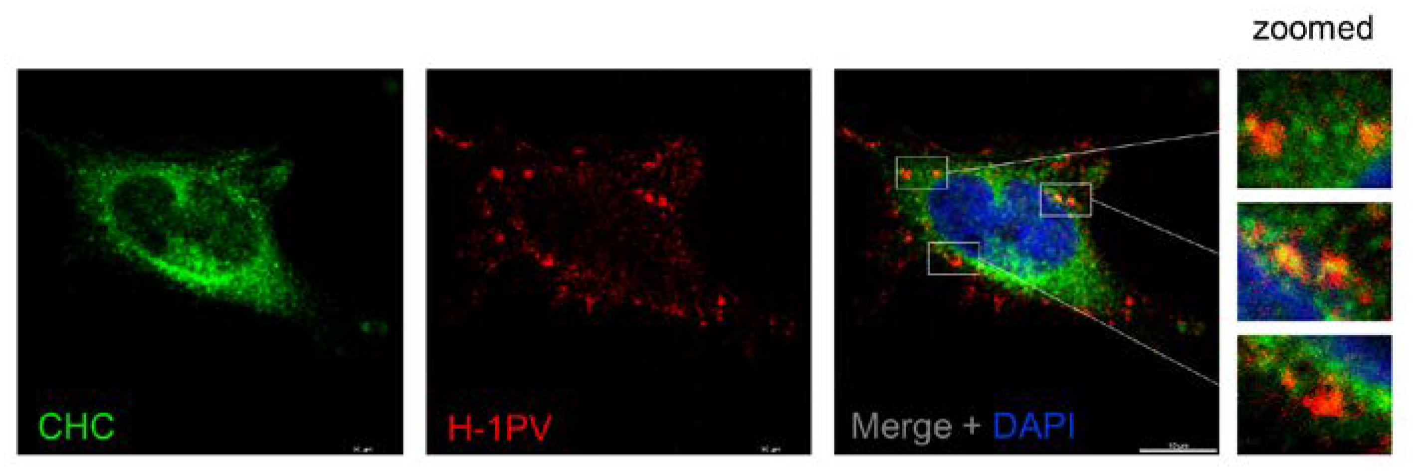 Viruses 12 01199 g002 Viruses 12 01199 g002