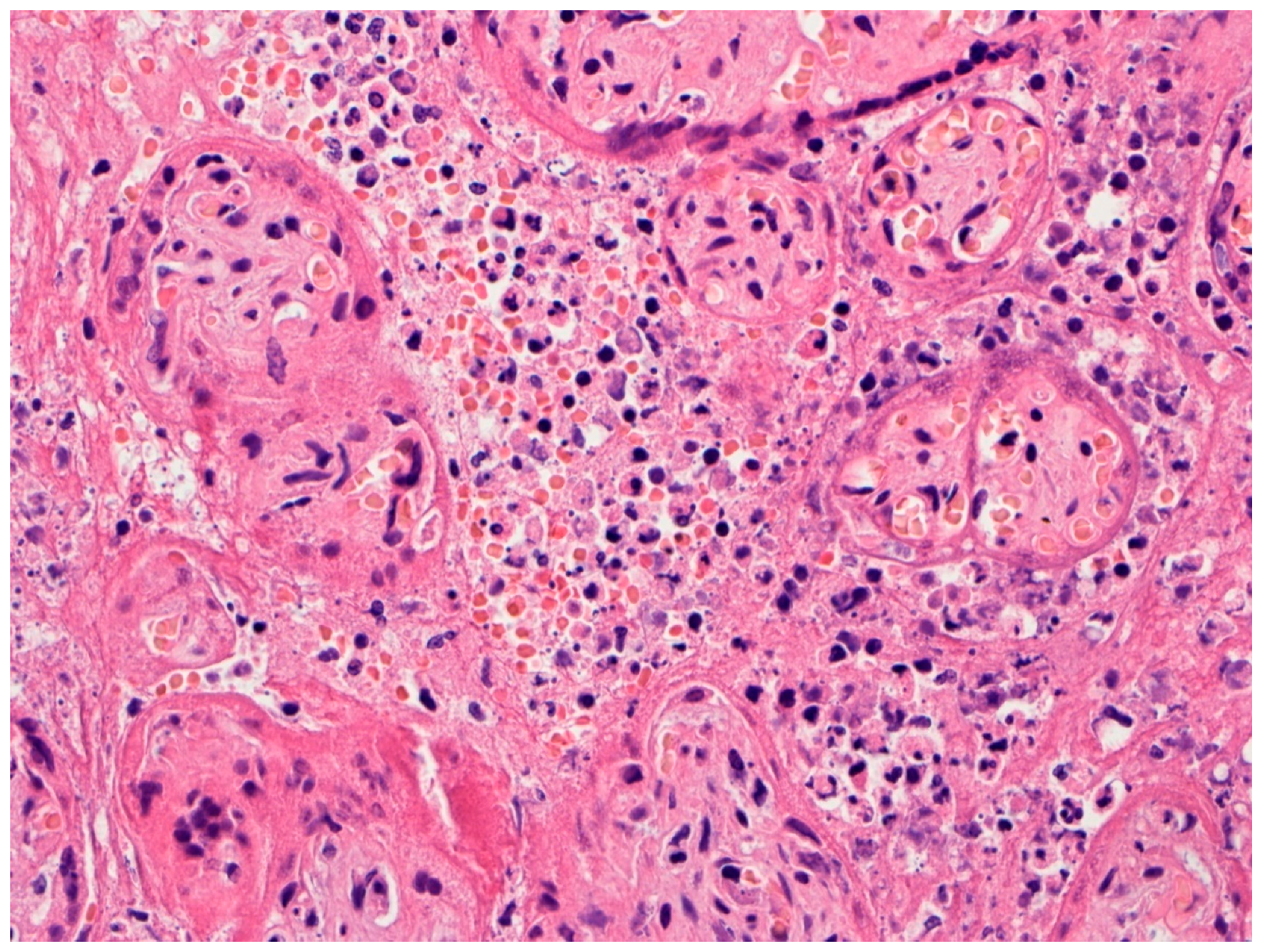 Viruses 12 01308 g004 Viruses 12 01308 g004