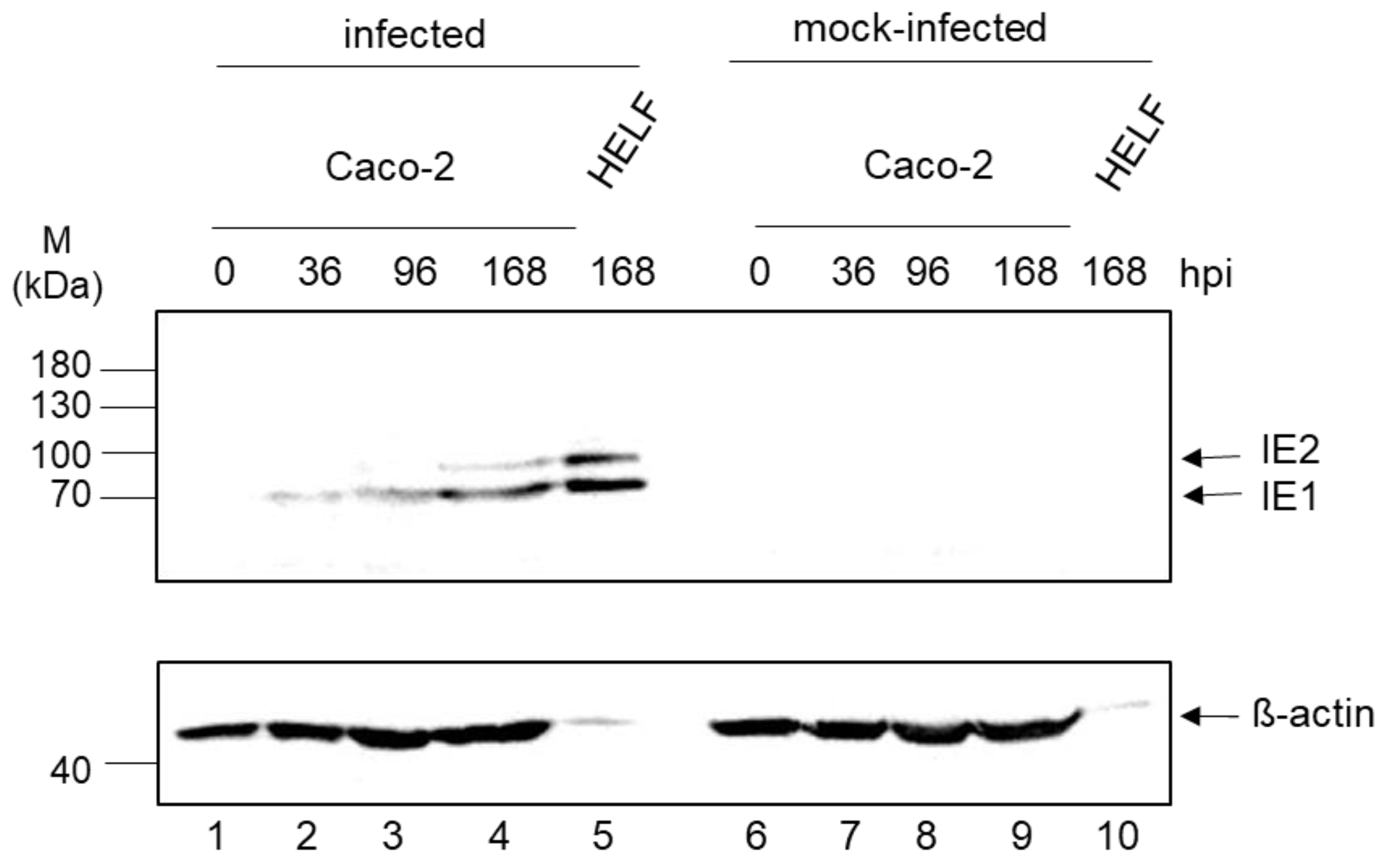 Viruses 13 00083 g004 Viruses 13 00083 g004