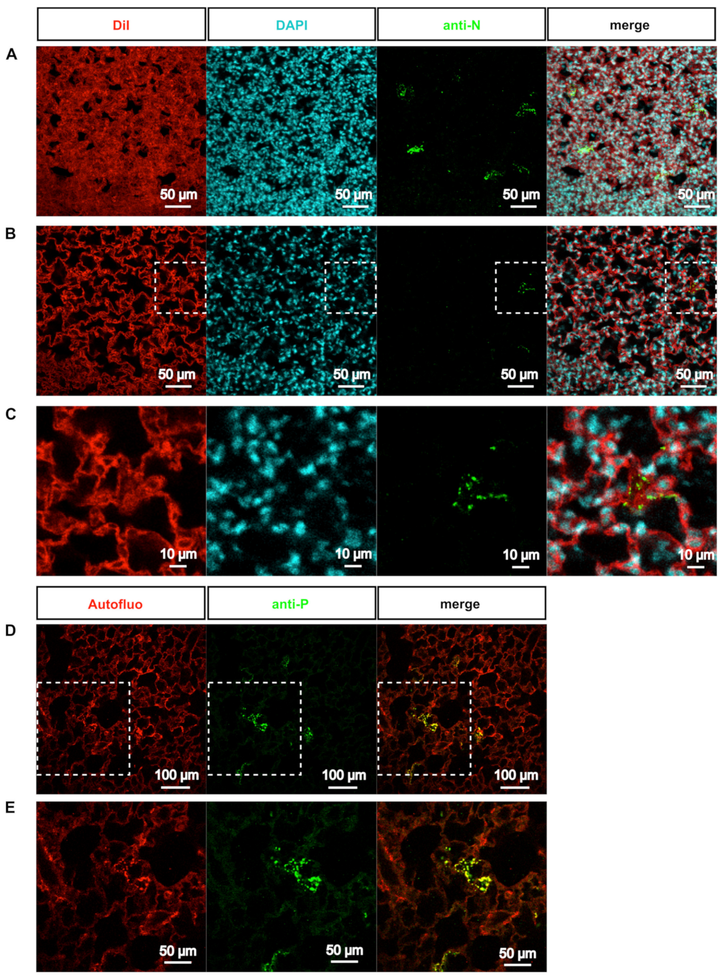 Functional organization of cytoplasmic inclusion bodies in cells infected  by respiratory syncytial virus