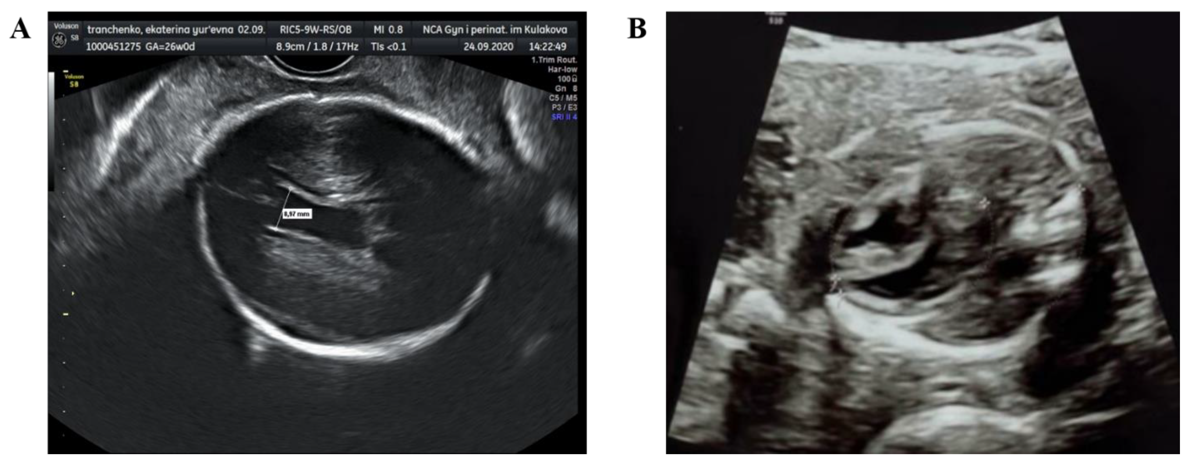 Viruses 13 00447 g001