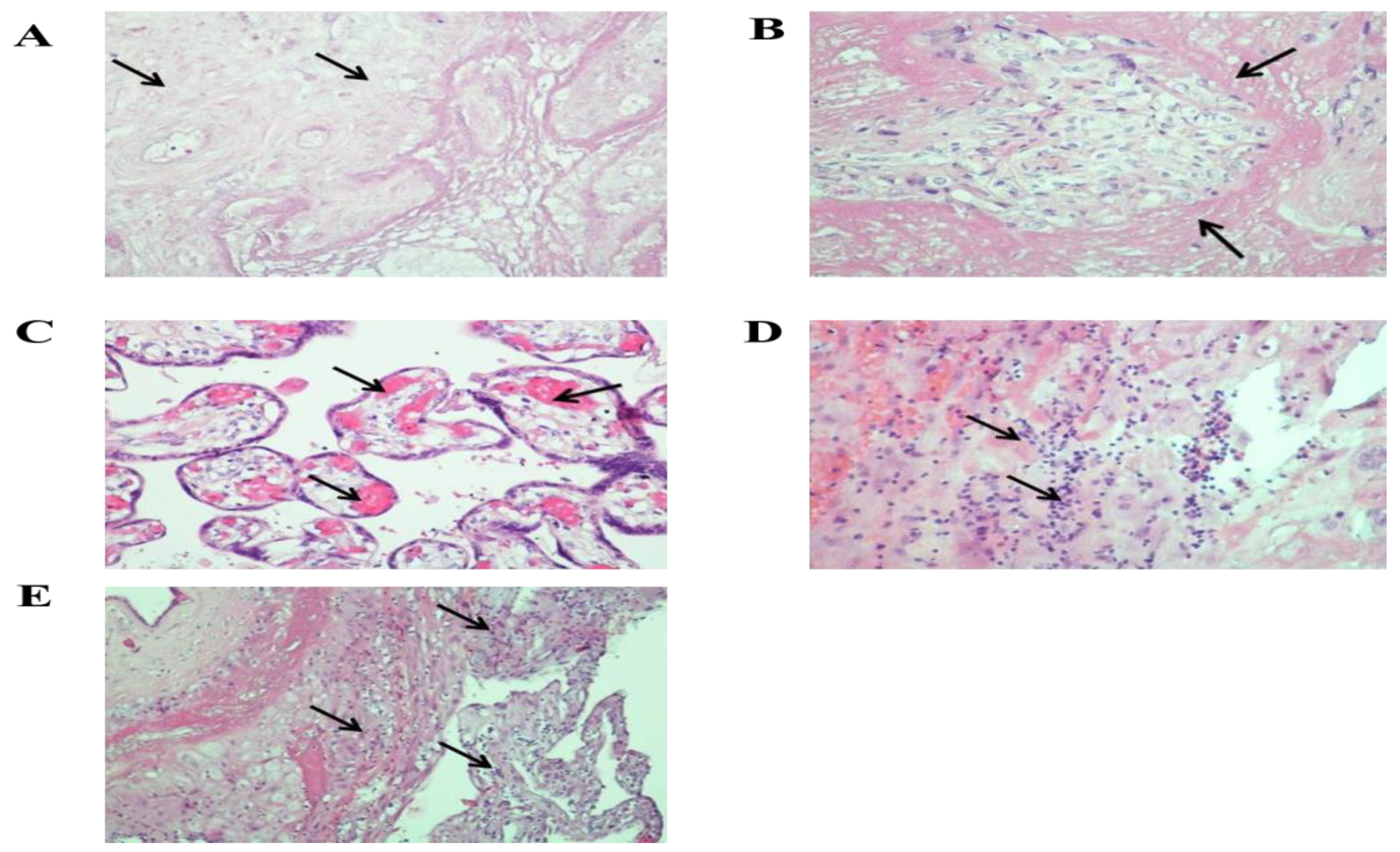 Viruses 13 00447 g002