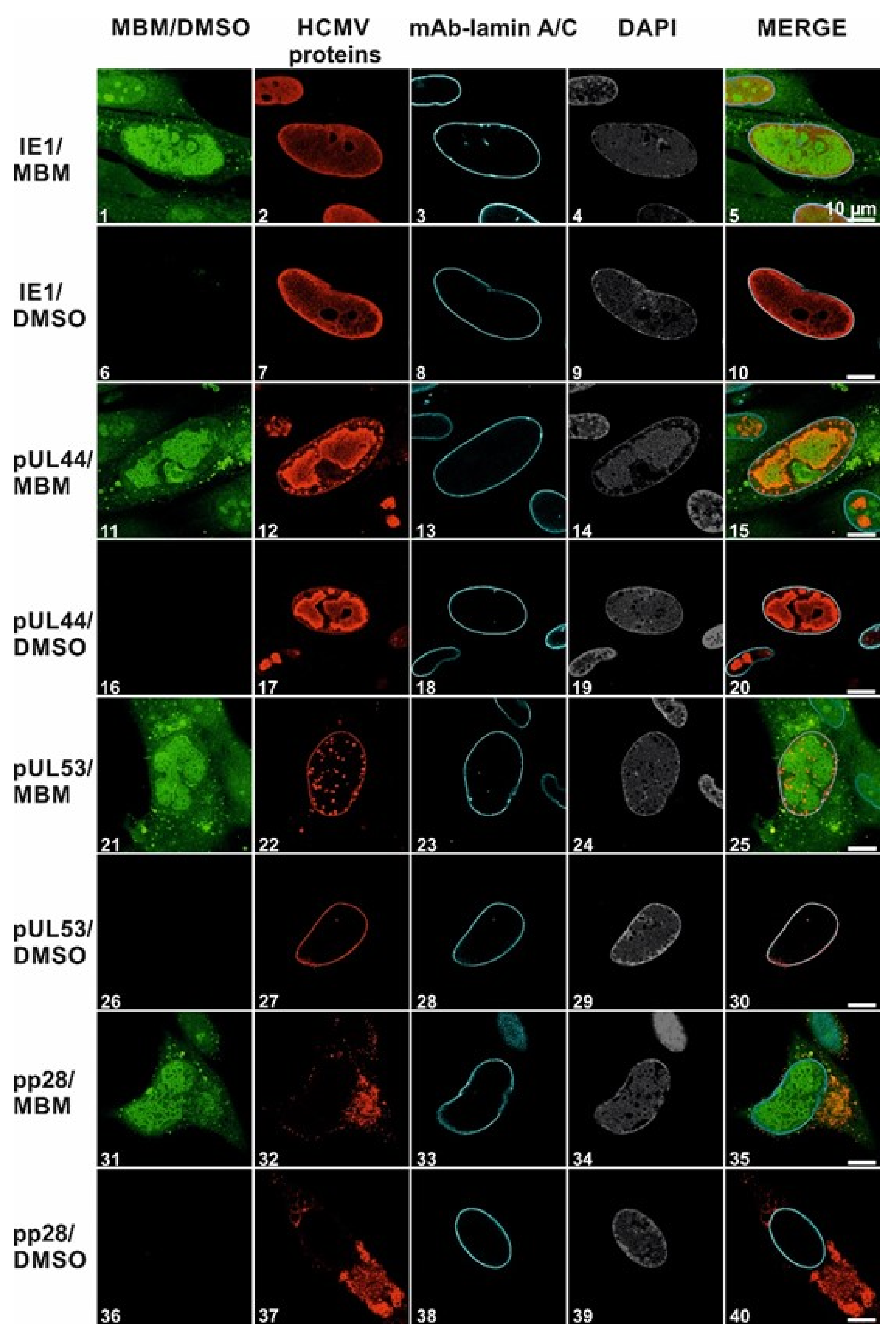 Viruses 13 00471 g006
