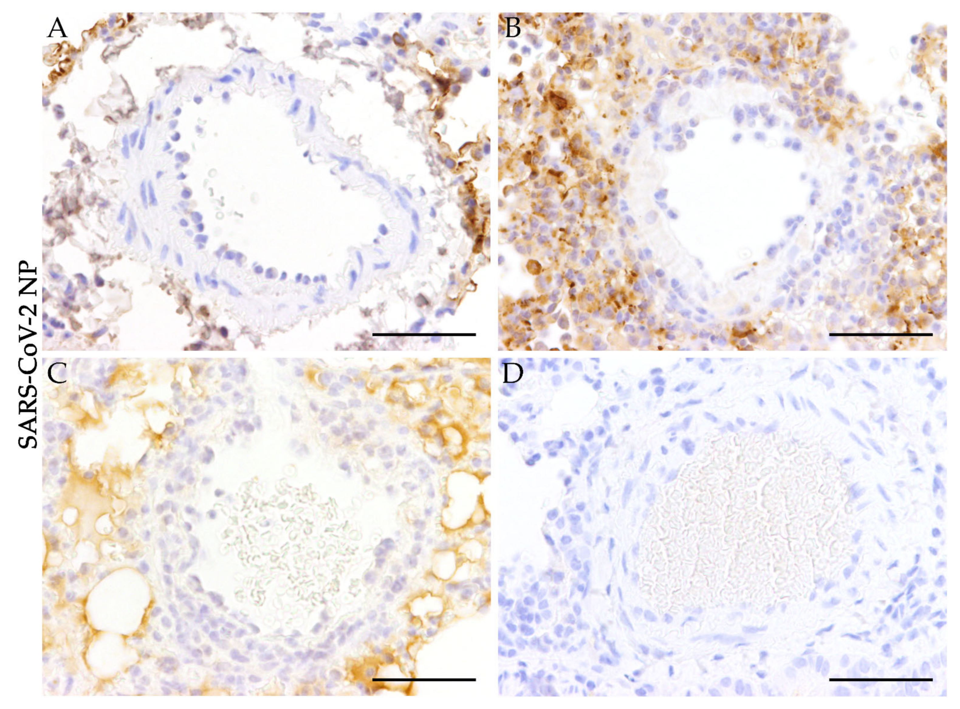 Viruses 13 00639 g003 Viruses 13 00639 g003